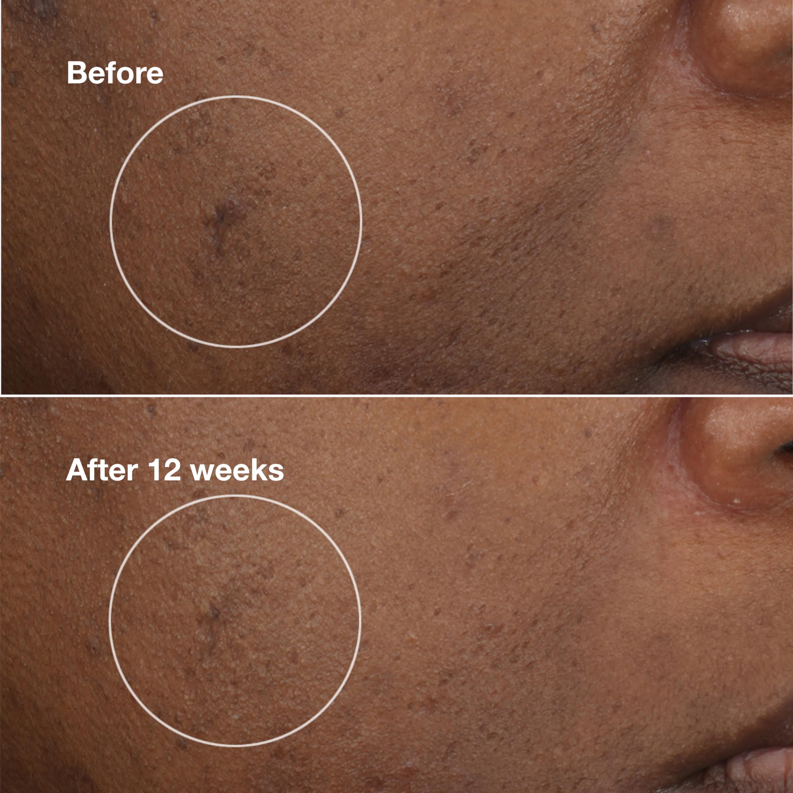 Foto 5 pulgar | Crema Hidratante Clinique Even Better Clinical Brightening 30 Ml - Venta Internacional.