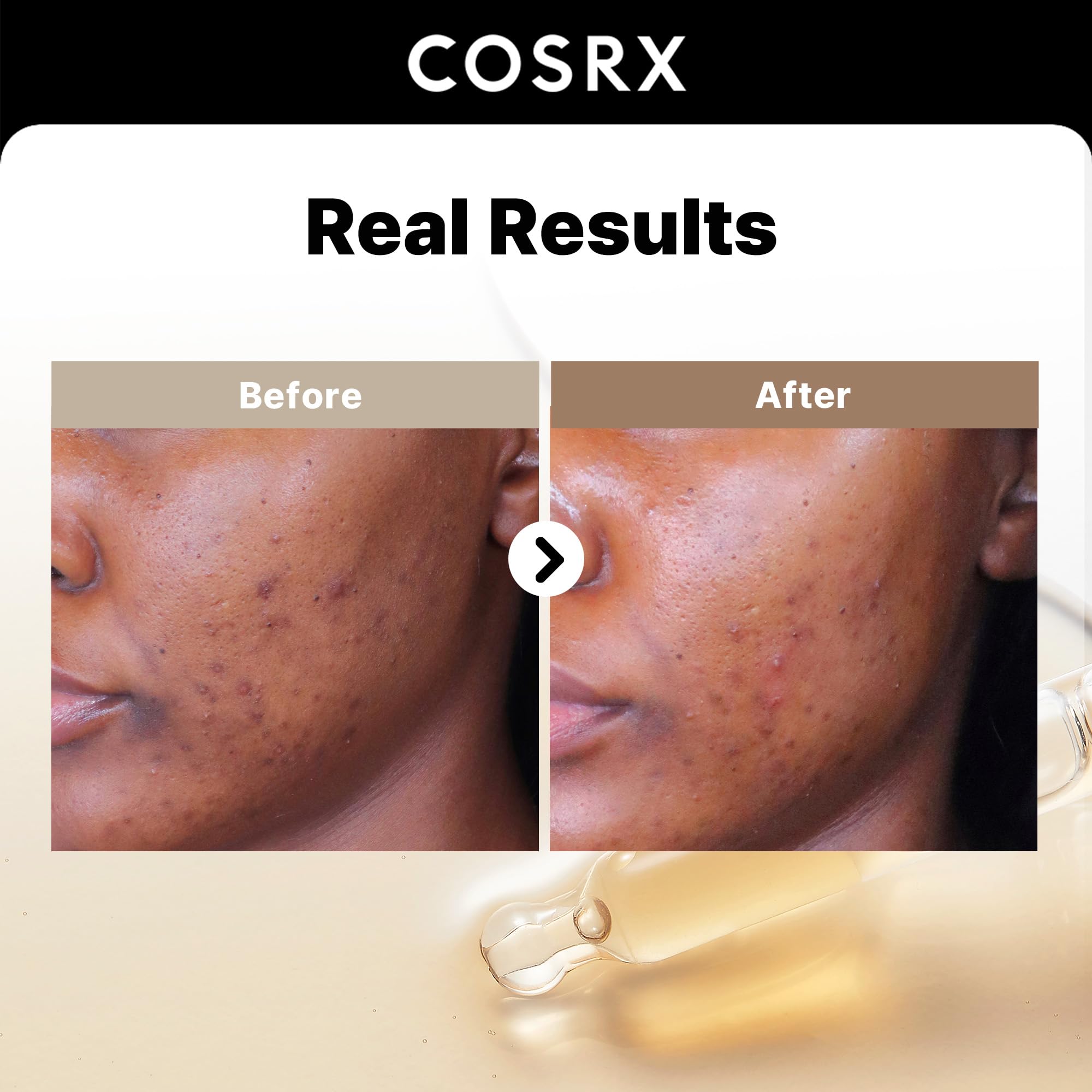 Foto 3 pulgar | Sérum Cosrx Alpha Arbutin 2% Decolorante Care, 50 Ml Con Niacinamida - Venta Internacional.