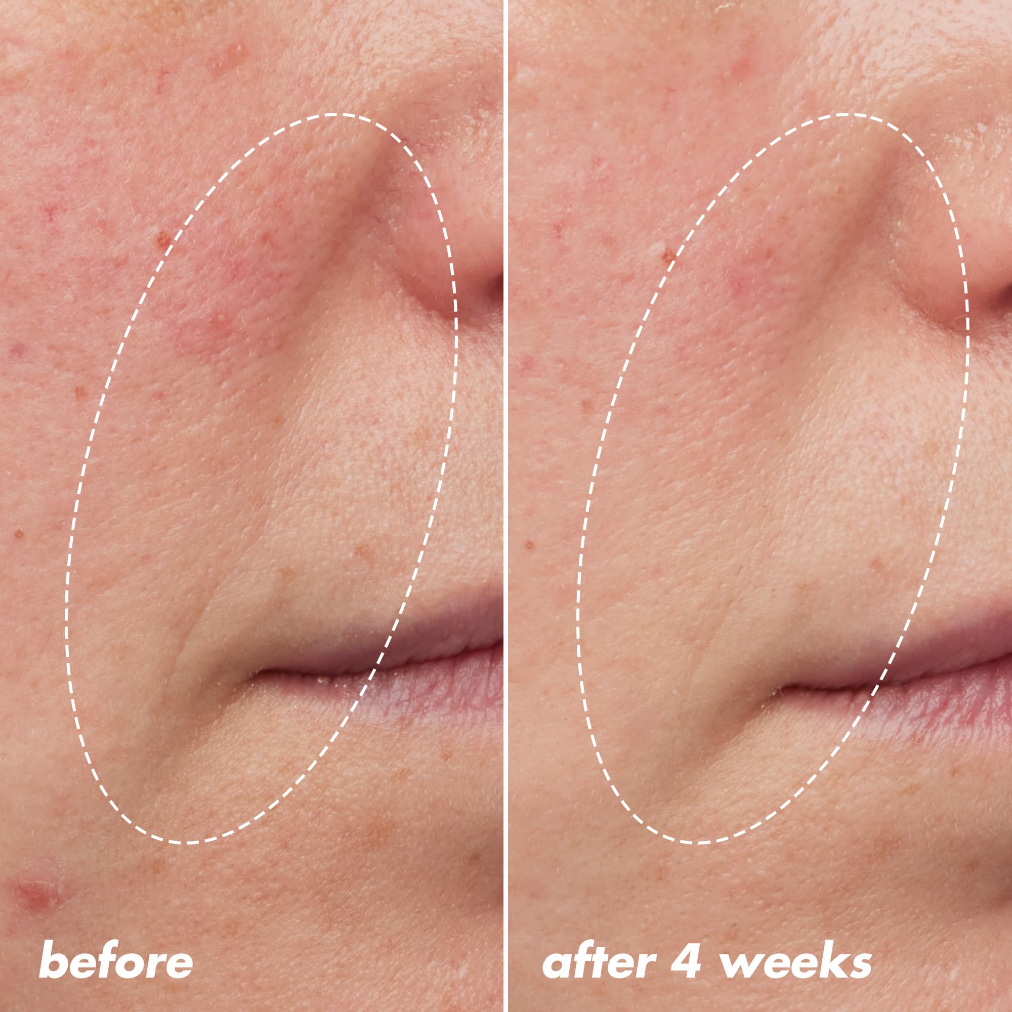 Foto 6 pulgar | Aceite Nocturno E.l.f. Skin Youth Boosting Blue-ty Sleep Vegan - Venta Internacional.