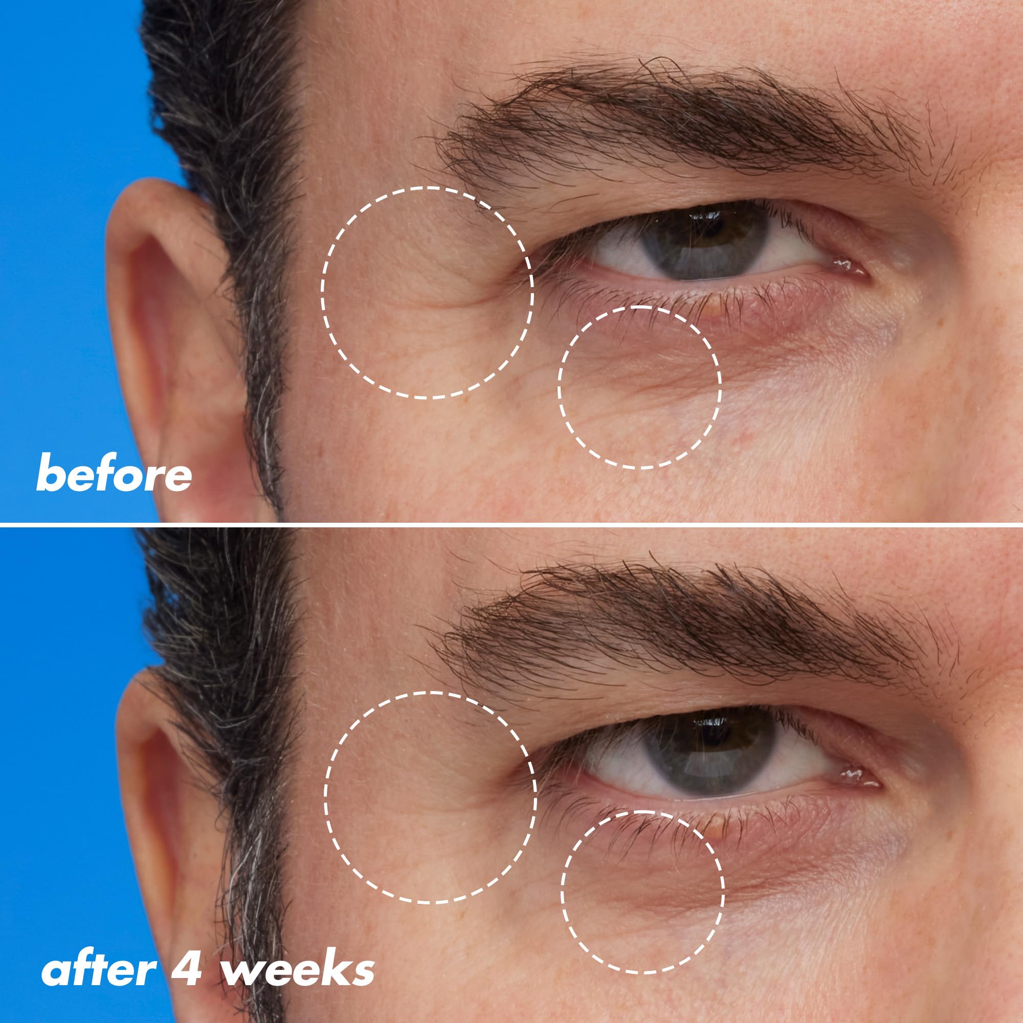 Foto 7 pulgar | Aceite Nocturno E.l.f. Skin Youth Boosting Blue-ty Sleep Vegan - Venta Internacional.