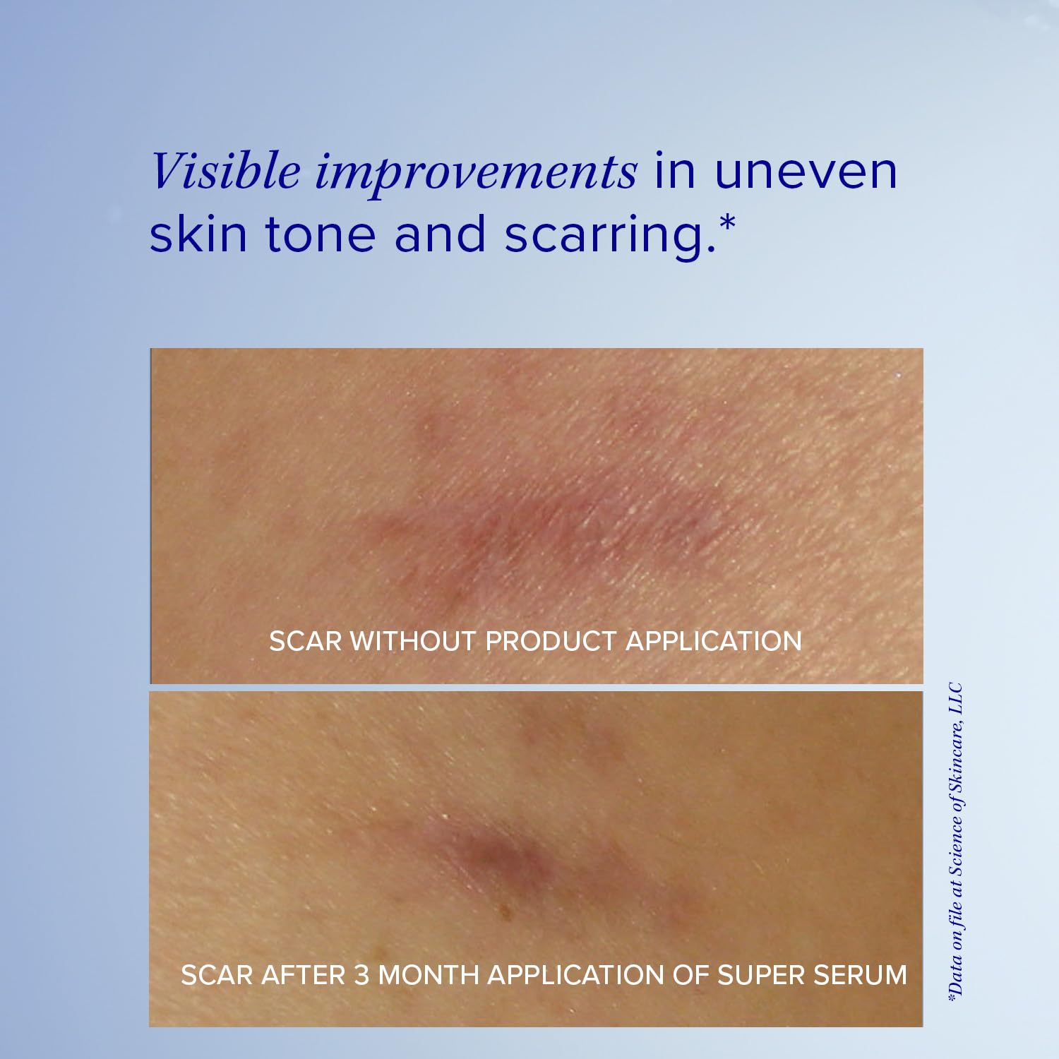 Foto 4 pulgar | Sérum Facial Is Clinical Super Serum Advance+ 30 Ml Antienvejecimiento - Venta Internacional.
