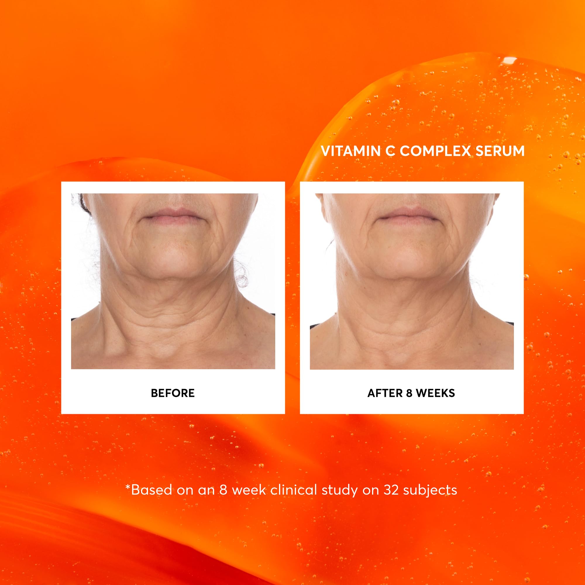 Foto 5 pulgar | Serum Naturium Con Complejo De Vitamina C Para Rostro, 60 Ml, Con Ácido Hialurónico - Venta Internacional.