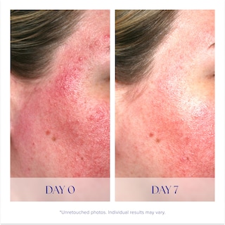 Foto 4 | Serum Is Clinical Pro-heal Serum Advance+ Antioxidante 30 Ml - Venta Internacional.