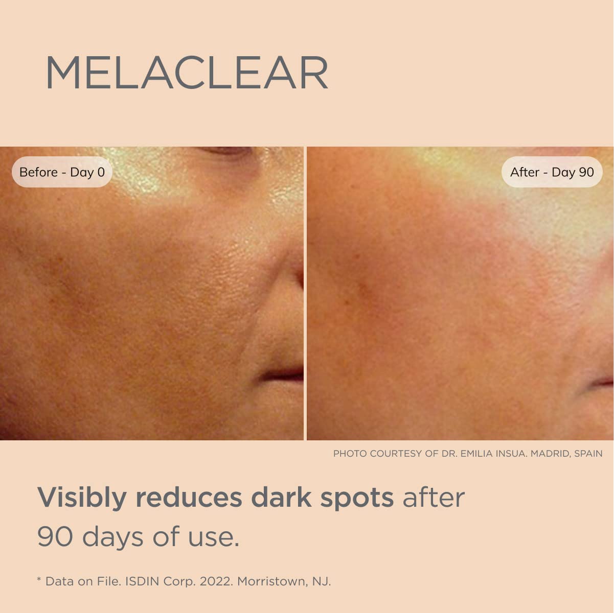 Foto 4 | Sérum Corrector De Manchas Oscuras Isdin Melaclear Con Vitamina C - Venta Internacional.
