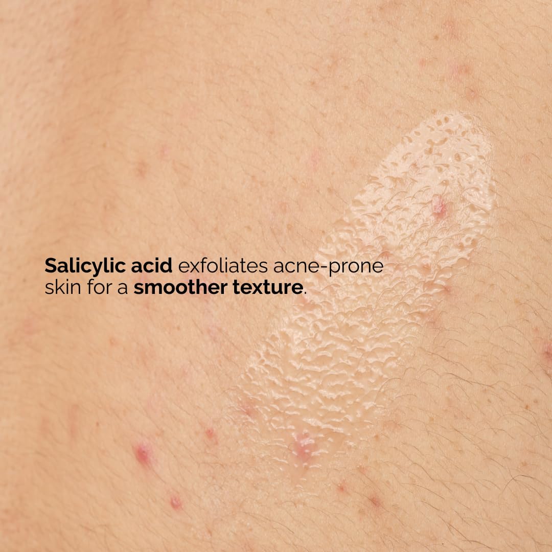 Foto 5 pulgar | Sérum Corporal The Ordinary Salicylic Acid 0,5% 240 Ml - Venta Internacional.