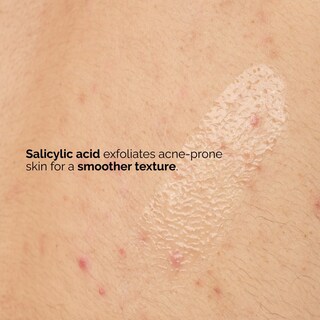 Foto 4 | Sérum Corporal The Ordinary Salicylic Acid 0,5% 240 Ml - Venta Internacional.