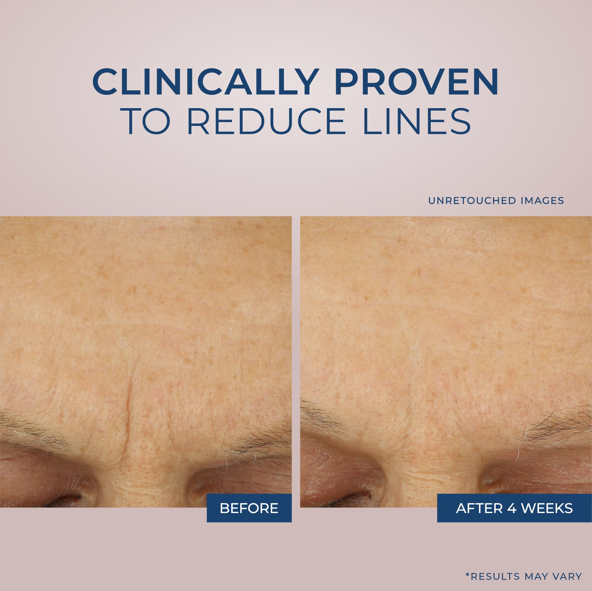 Foto 4 pulgar | Crema Hidratante Roc Retinol Correxion Max Daily Hydration 50 Ml - Venta Internacional.