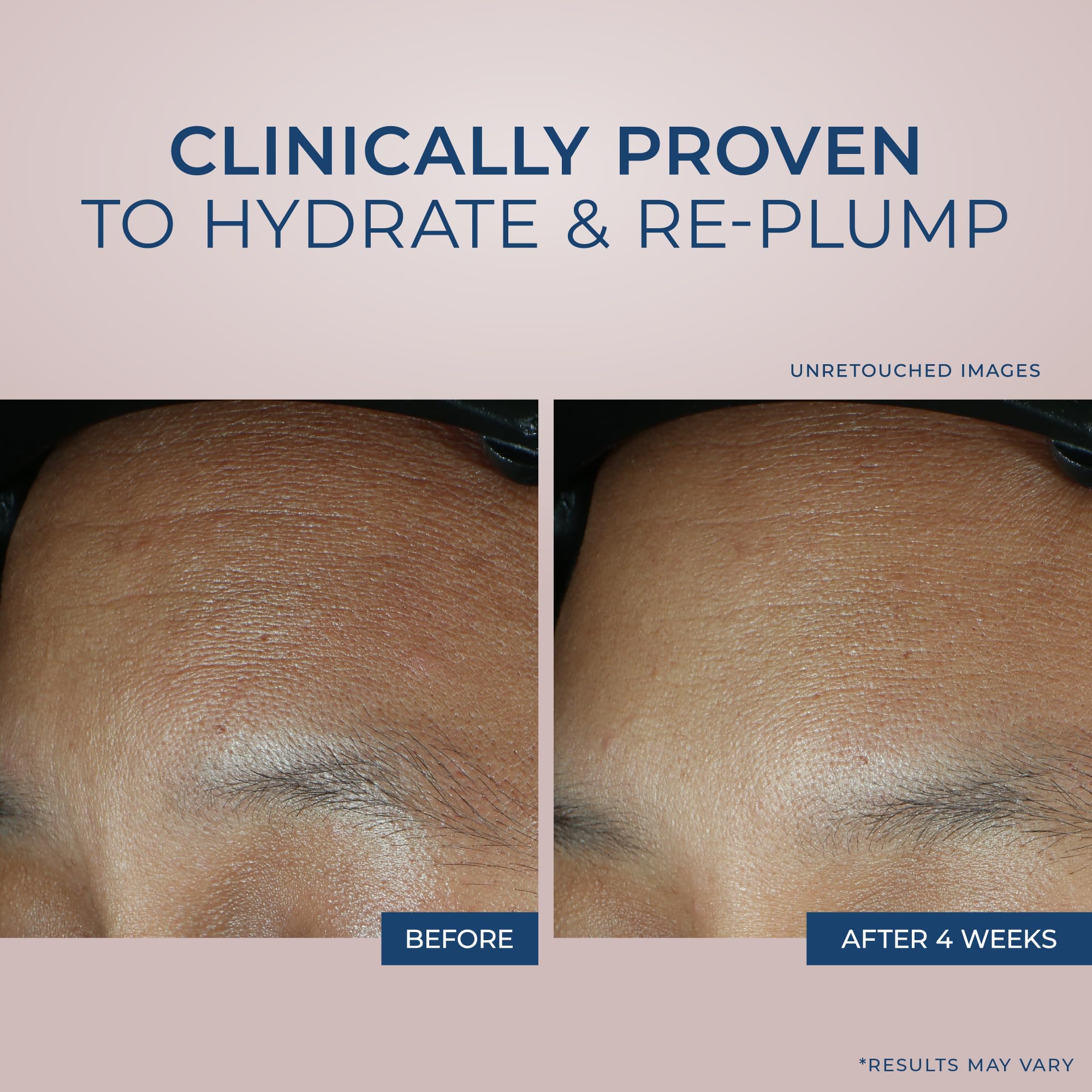 Foto 4 | Crema Hidratante Roc Retinol Correxion Max Daily Hydration 50 Ml - Venta Internacional.