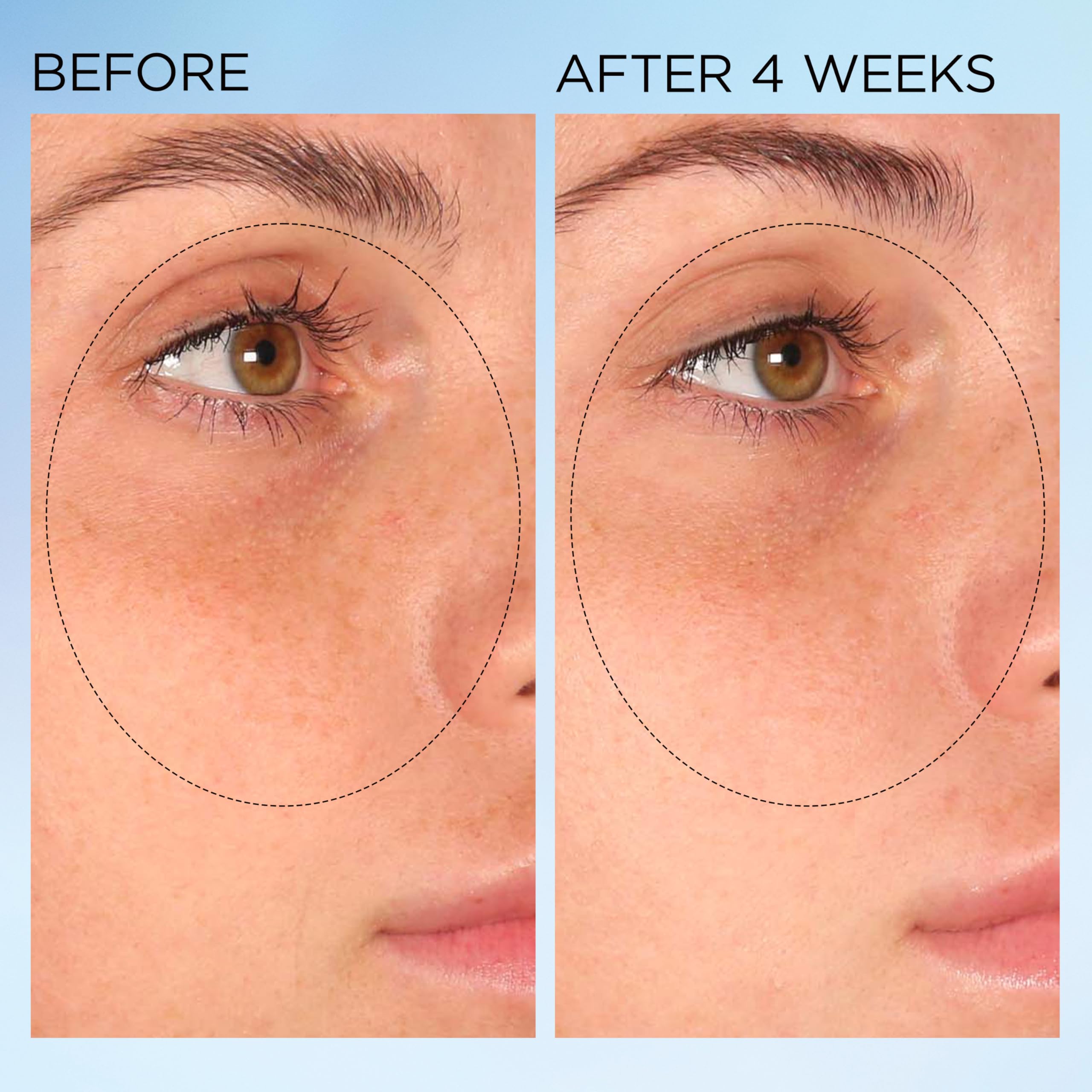 Foto 7 | Cápsulas Correctoras De Manchas Elizabeth Arden Visible Brightening - Venta Internacional.