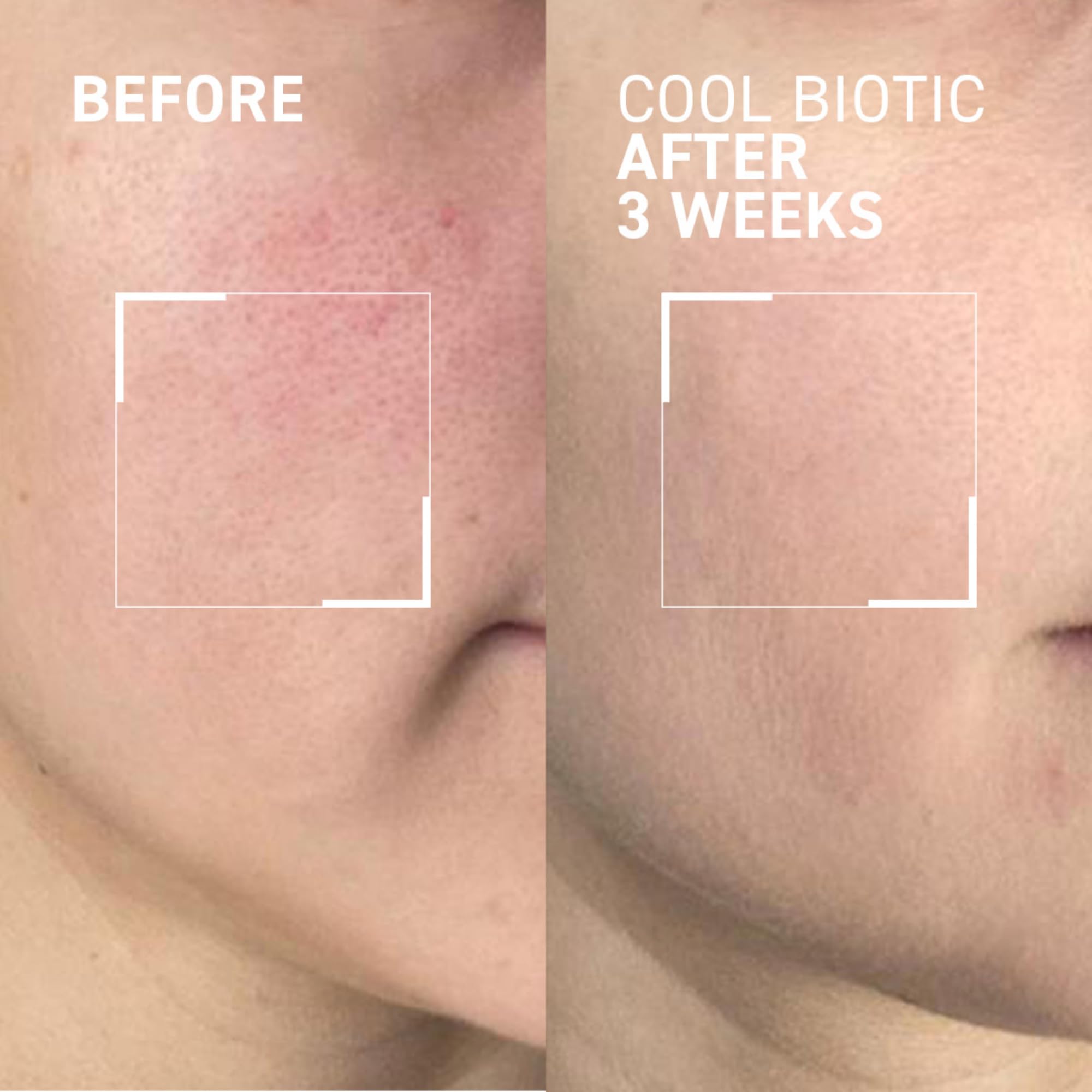Foto 3 pulgar | Crema Dr. Brandt Cool Biotic Prebiotic Para Aliviar El Enrojecimiento, 50 Ml - Venta Internacional.