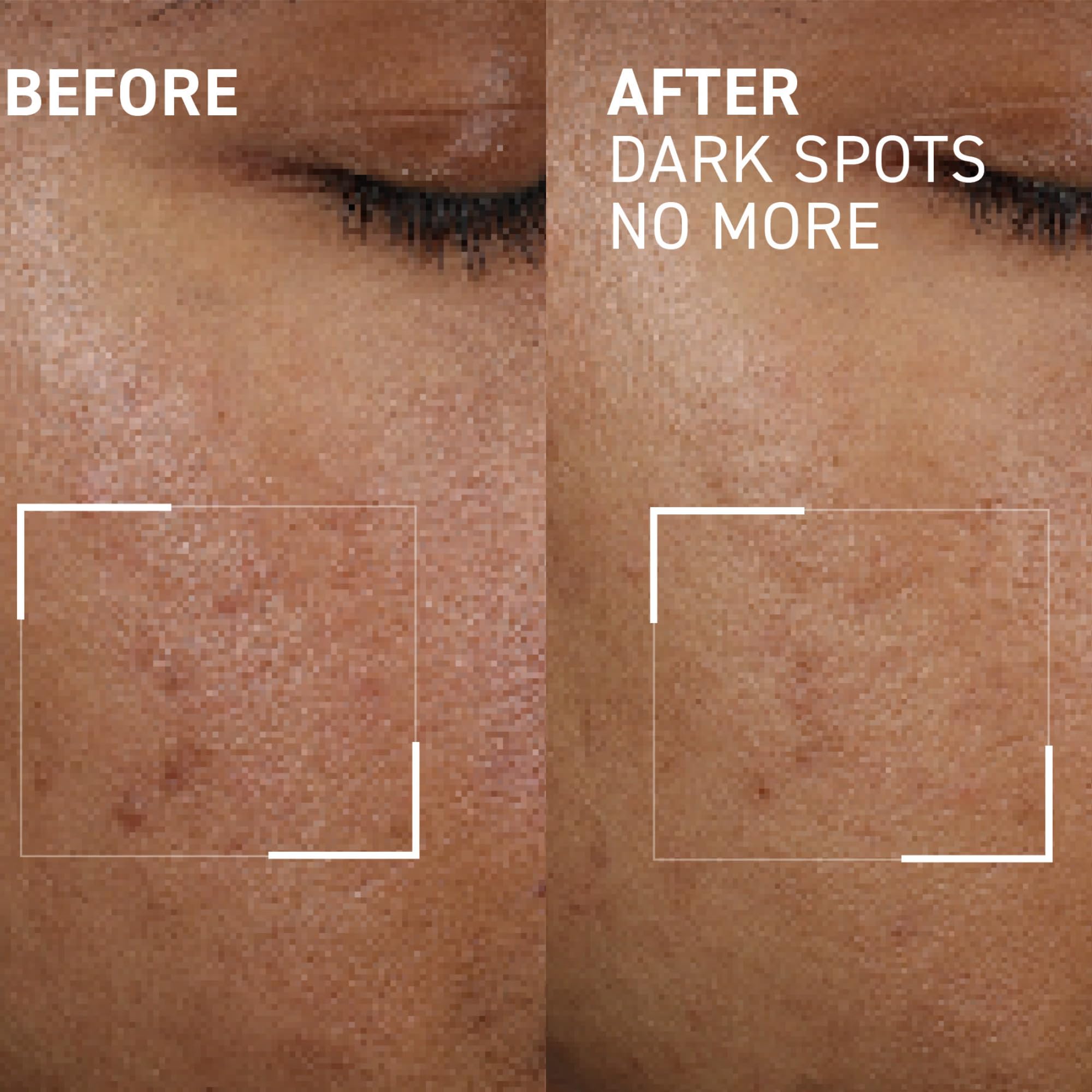Foto 4 pulgar | Concentrado Minimizador De Manchas Dr. Brandt Bright This Way, 15 Ml - Venta Internacional.