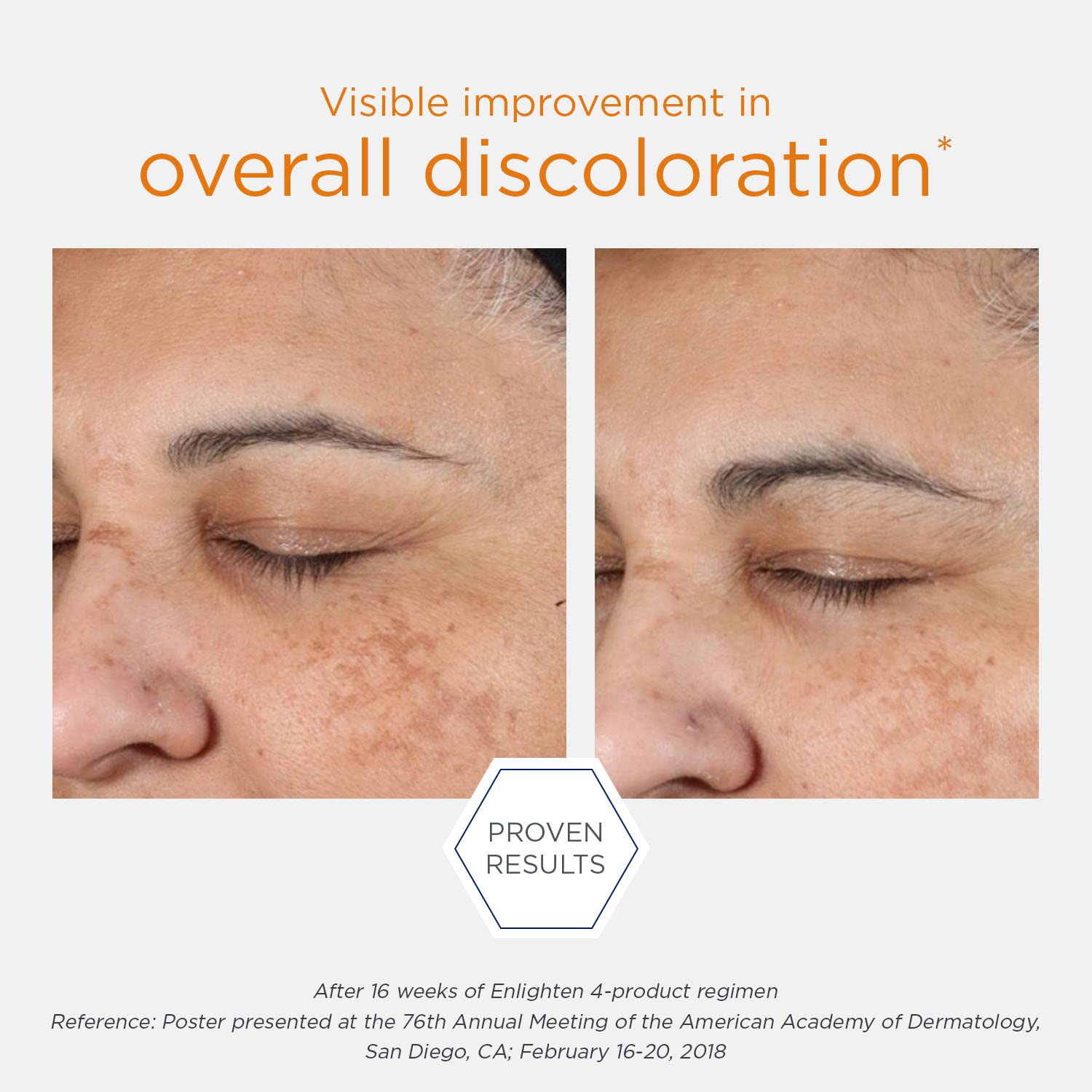 Foto 6 | Tratamiento Facial Neostrata Pigment Controller Brightening - Venta Internacional.