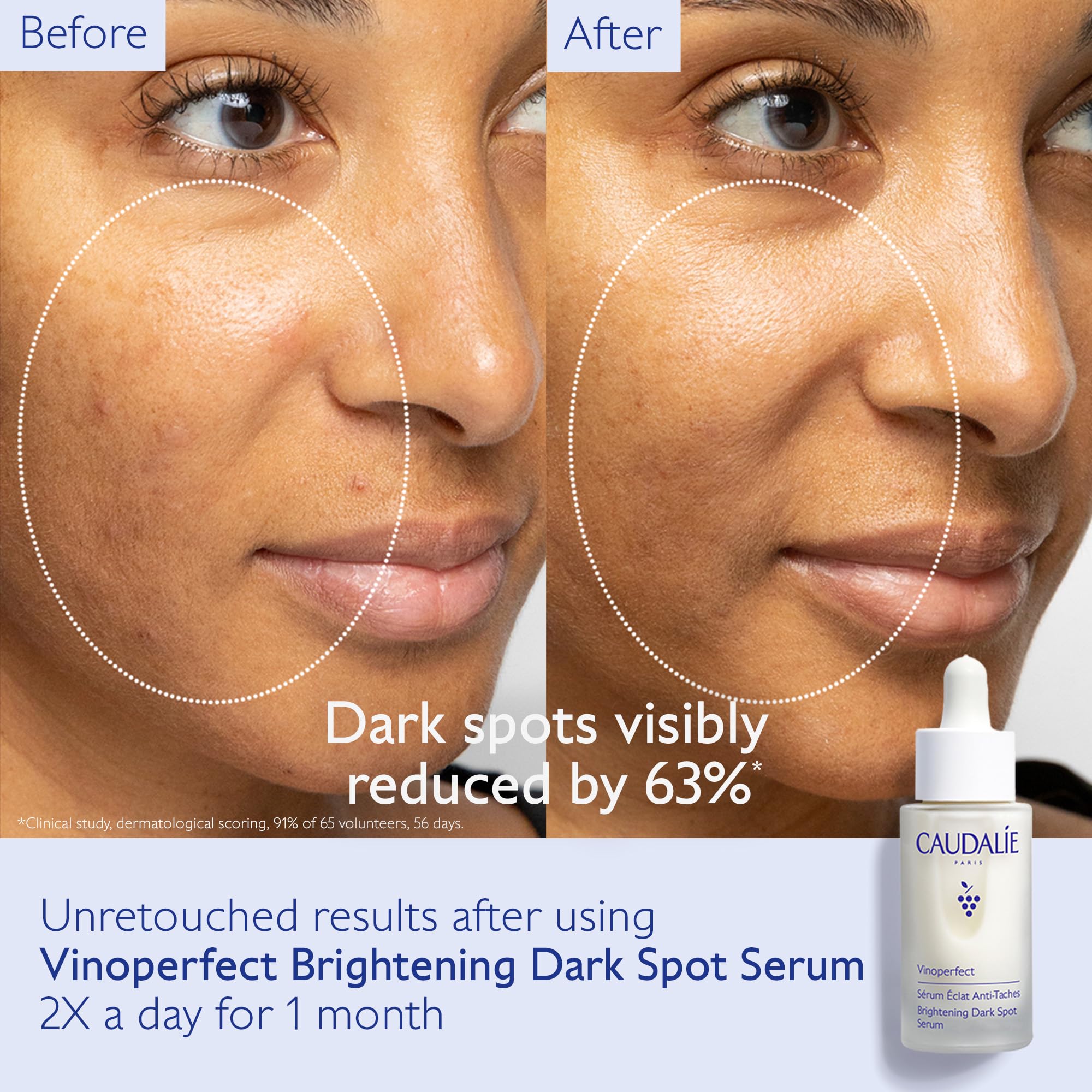 Foto 4 pulgar | Set Para El Cuidado De La Piel Caudalie Vinoperfect Brightening Dark Spot - Venta Internacional.