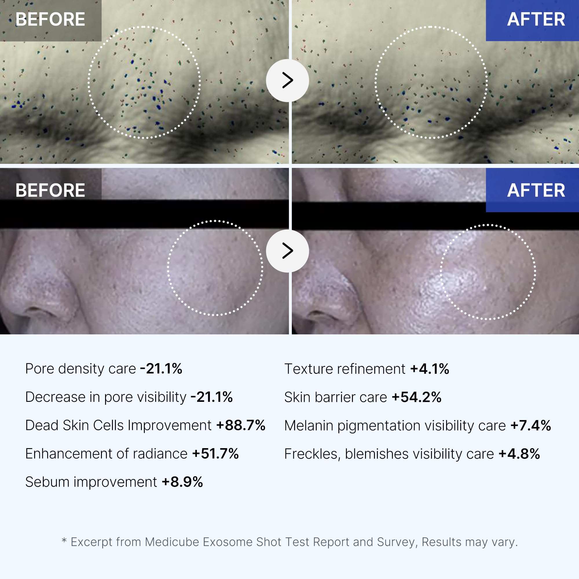 Foto 6 | Sérum Facial Medicube Zero Exosome Shot De 7.500 Ppm Spicule - Venta Internacional.