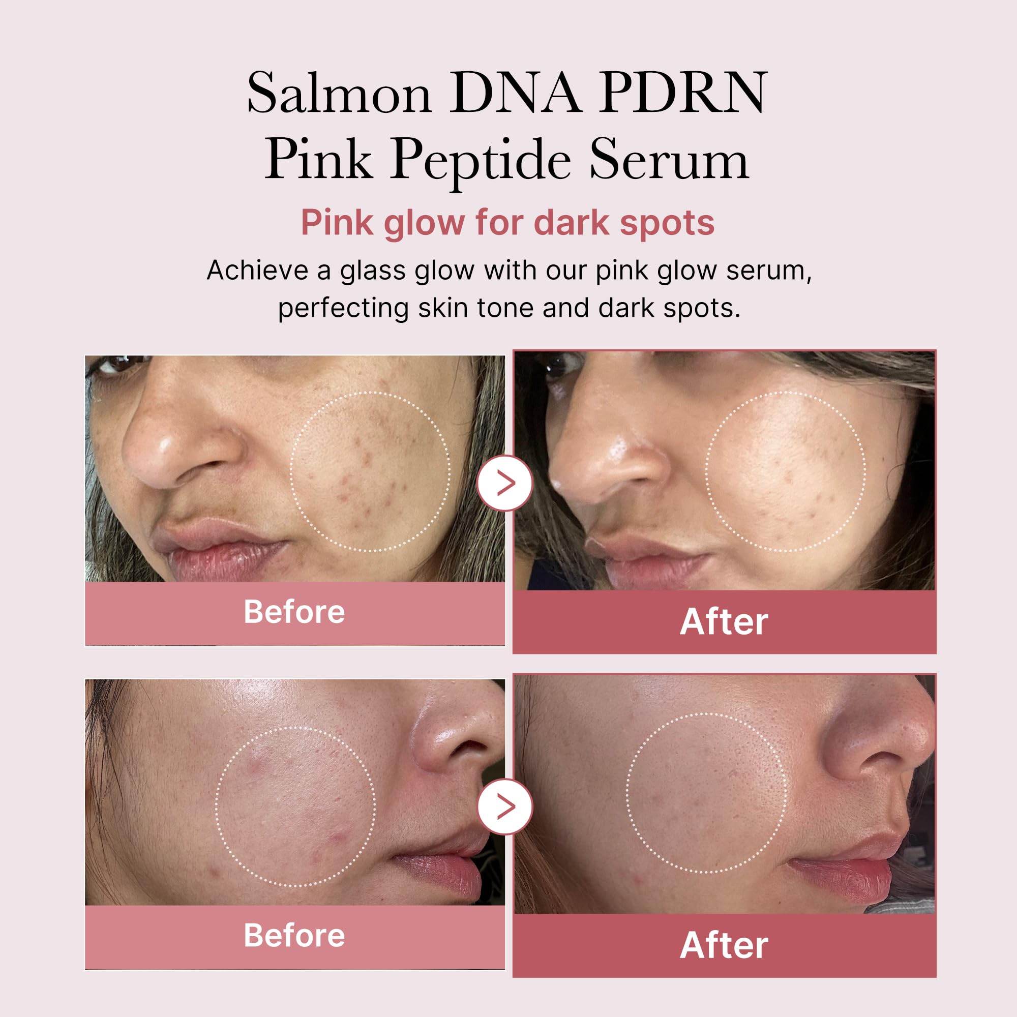 Foto 2 | Sérum Medicube, Adn De Salmón, Pdrn, Péptido Rosa, 30 Ml - Venta Internacional.
