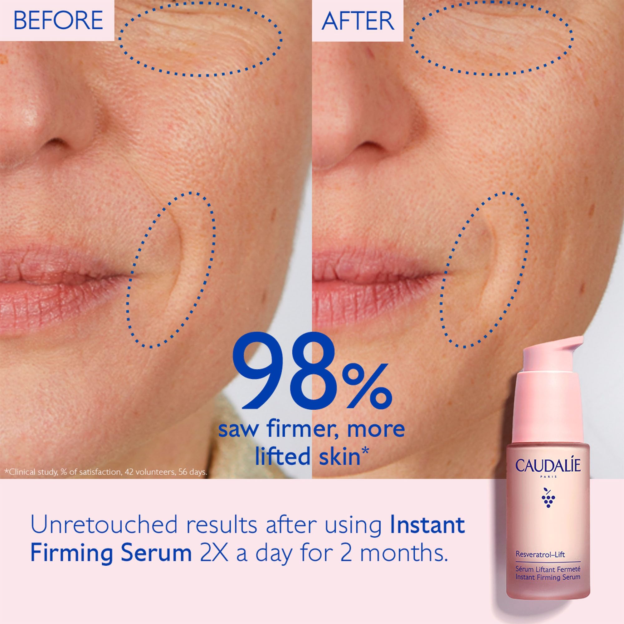 Foto 3 pulgar | Serum Caudalie Resveratrol-lift, Reafirmante Instantáneo, 30 Ml - Venta Internacional.
