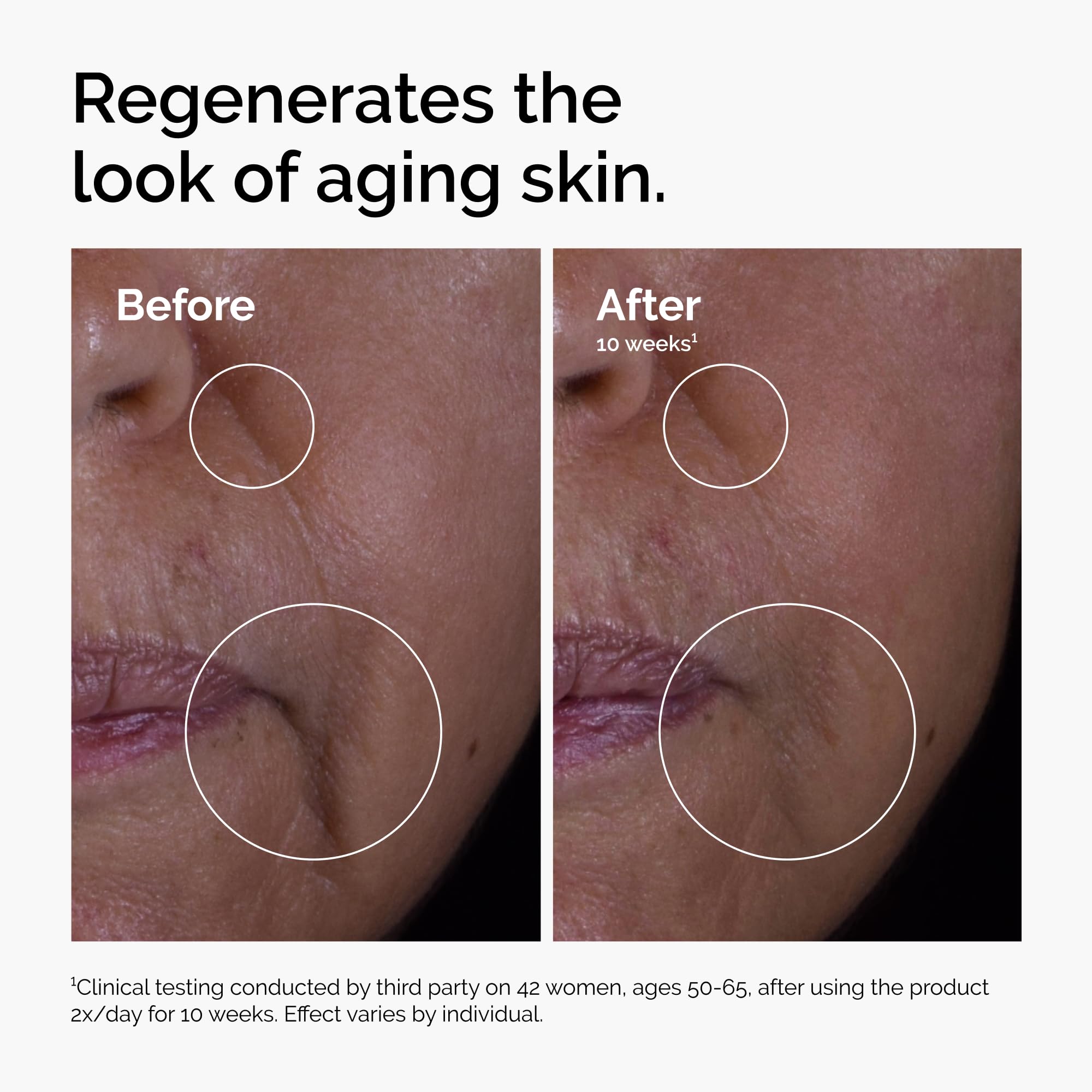 Foto 5 pulgar | Serum The Ordinary Gf, Solución Antienvejecimiento Al 15%, 30 Ml - Venta Internacional.