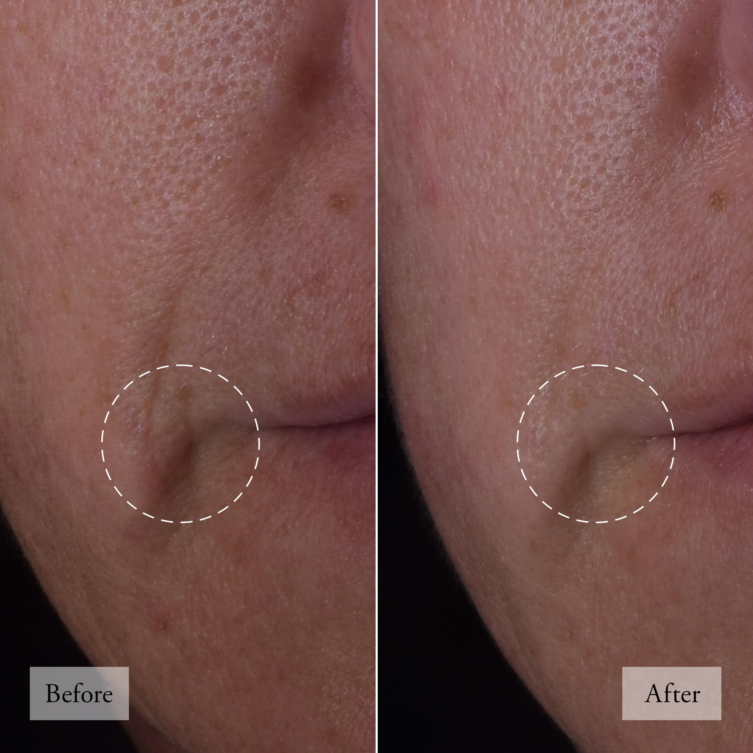 Foto 5 pulgar | Sérum Facial Philosophy Dose Of Wisdom Bouncy Skin Rebuilding - Venta Internacional.