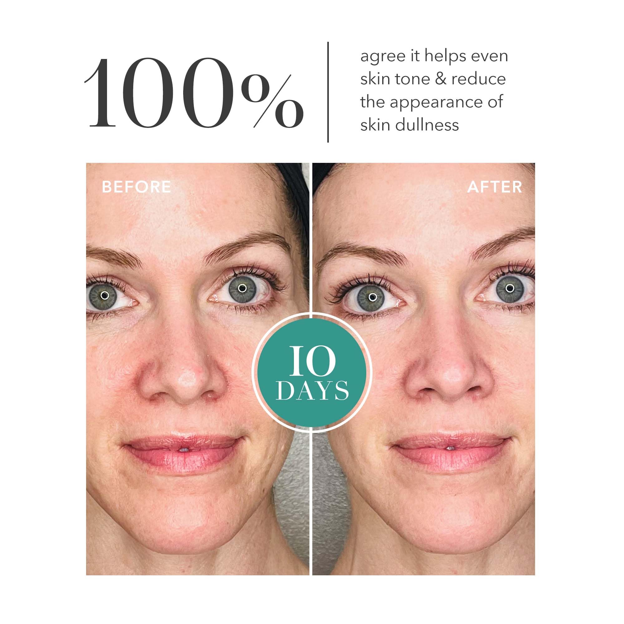 Foto 5 pulgar | Sérum De Colágeno Líquido Algenist Genius Liquid Collagen 100 Ml - Venta Internacional.