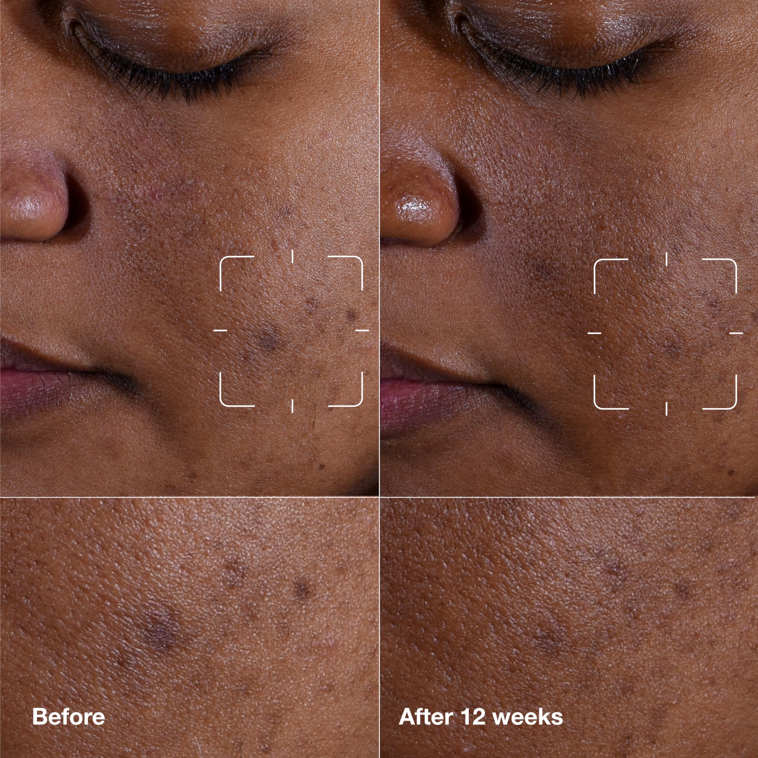 Foto 3 pulgar | Sérum Clinique Even Better Clinical Dark Spot, 50 Ml, Con Vitamina C - Venta Internacional.
