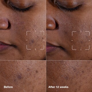 Foto 2 | Sérum Clinique Even Better Clinical Dark Spot, 50 Ml, Con Vitamina C - Venta Internacional.