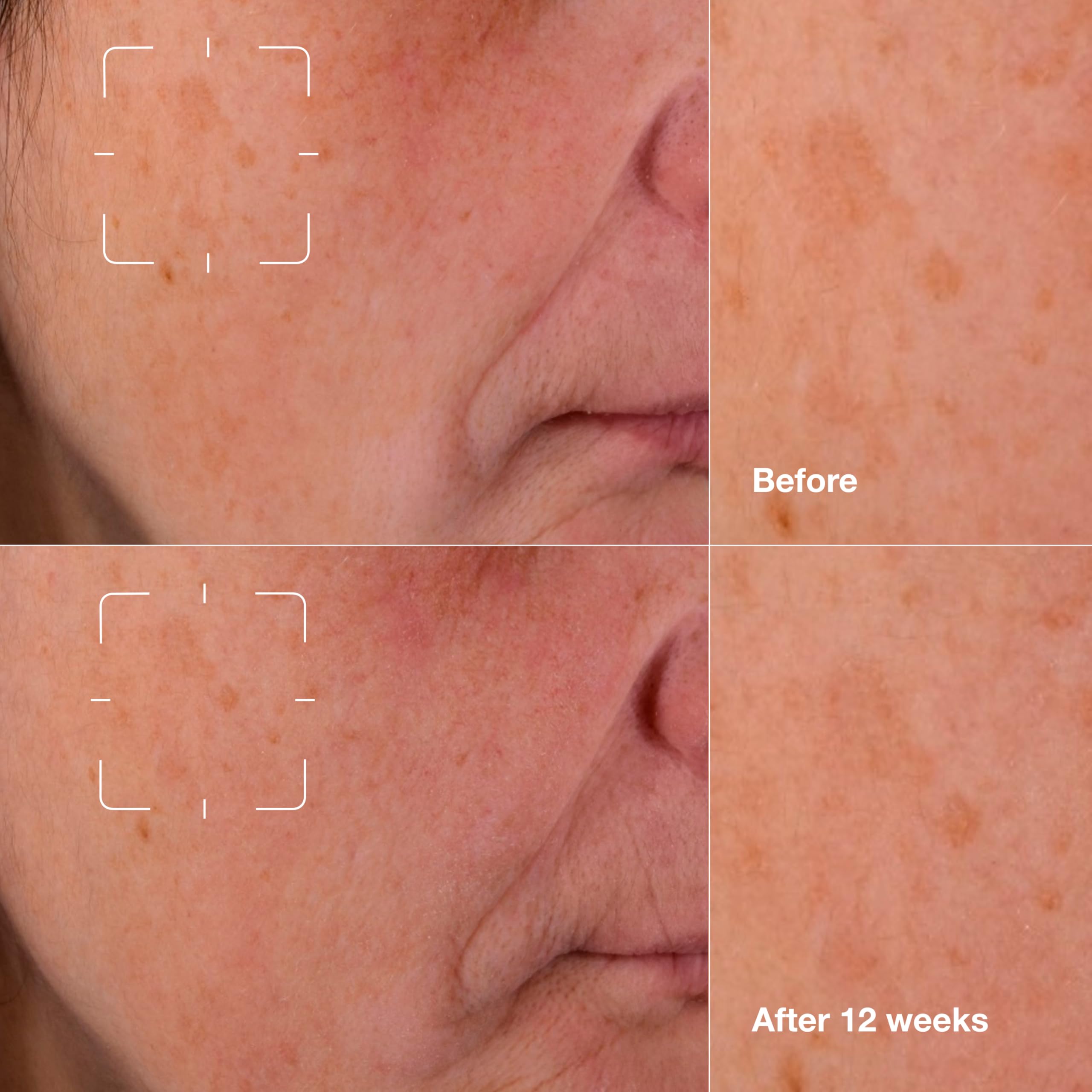 Foto 4 pulgar | Sérum Clinique Even Better Clinical Dark Spot, 50 Ml, Con Vitamina C - Venta Internacional.