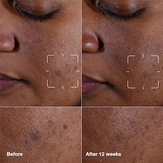 Foto 2 | Serum Clinique Even Better Clinical Para Eliminar Manchas Oscuras, 75 Ml - Venta Internacional.