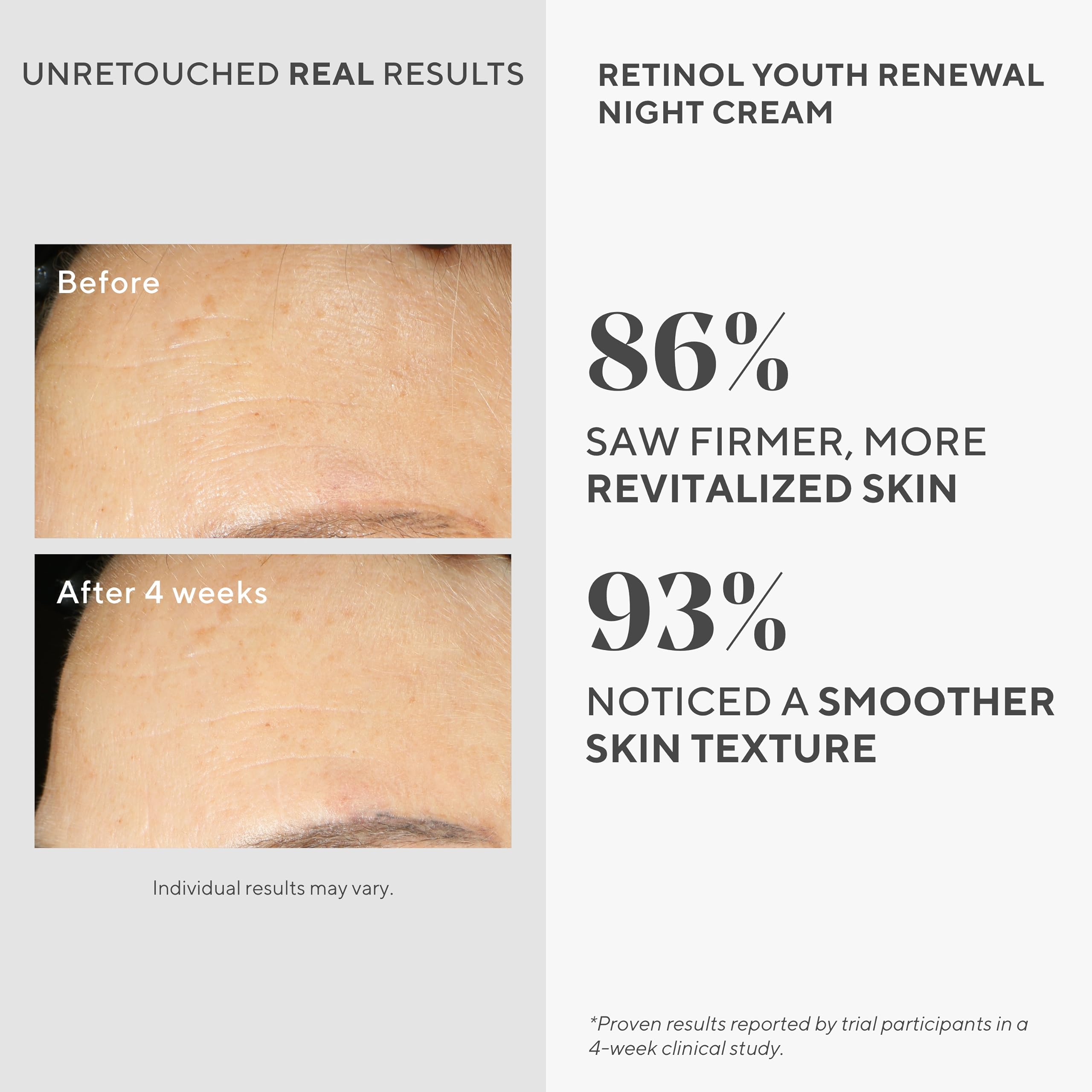 Foto 4 pulgar | Crema De Noche Murad Resurgence Retinol Youth Renewal 50 Ml - Venta Internacional.