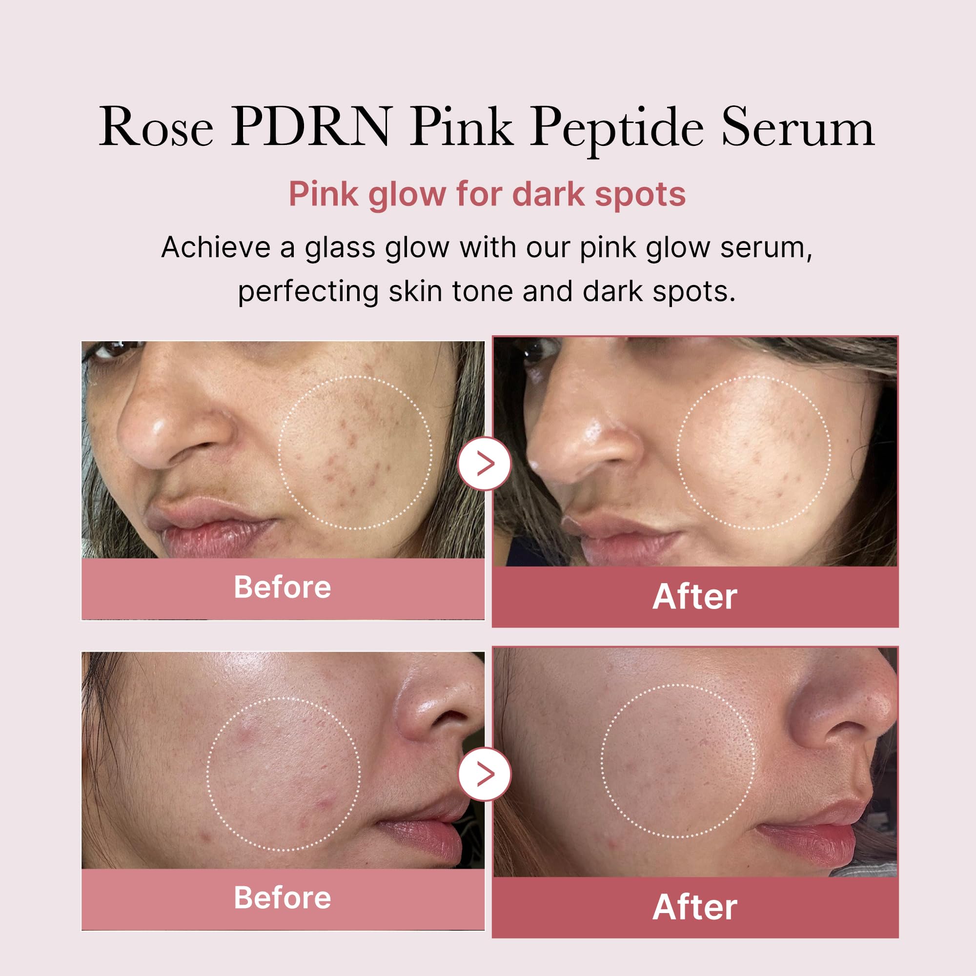 Foto 3 pulgar | Serum Medicube Rose Pdrn Pdrn Pink Peptide Para El Cuidado De La Piel Vegano, 30 Ml - Venta Internacional.