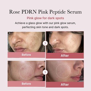 Foto 2 | Serum Medicube Rose Pdrn Pdrn Pink Peptide Para El Cuidado De La Piel Vegano, 30 Ml - Venta Internacional.
