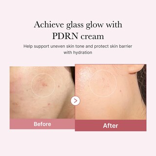 Foto 3 | Crema Hidratante Medicube Salmon Dna Pdrn Pink 50ml - Venta Internacional.