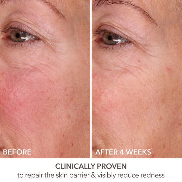 Foto 7 | Sérum Dr. Dennis Gross Derminfusions Fill & Repair 30 Ml - Venta Internacional.
