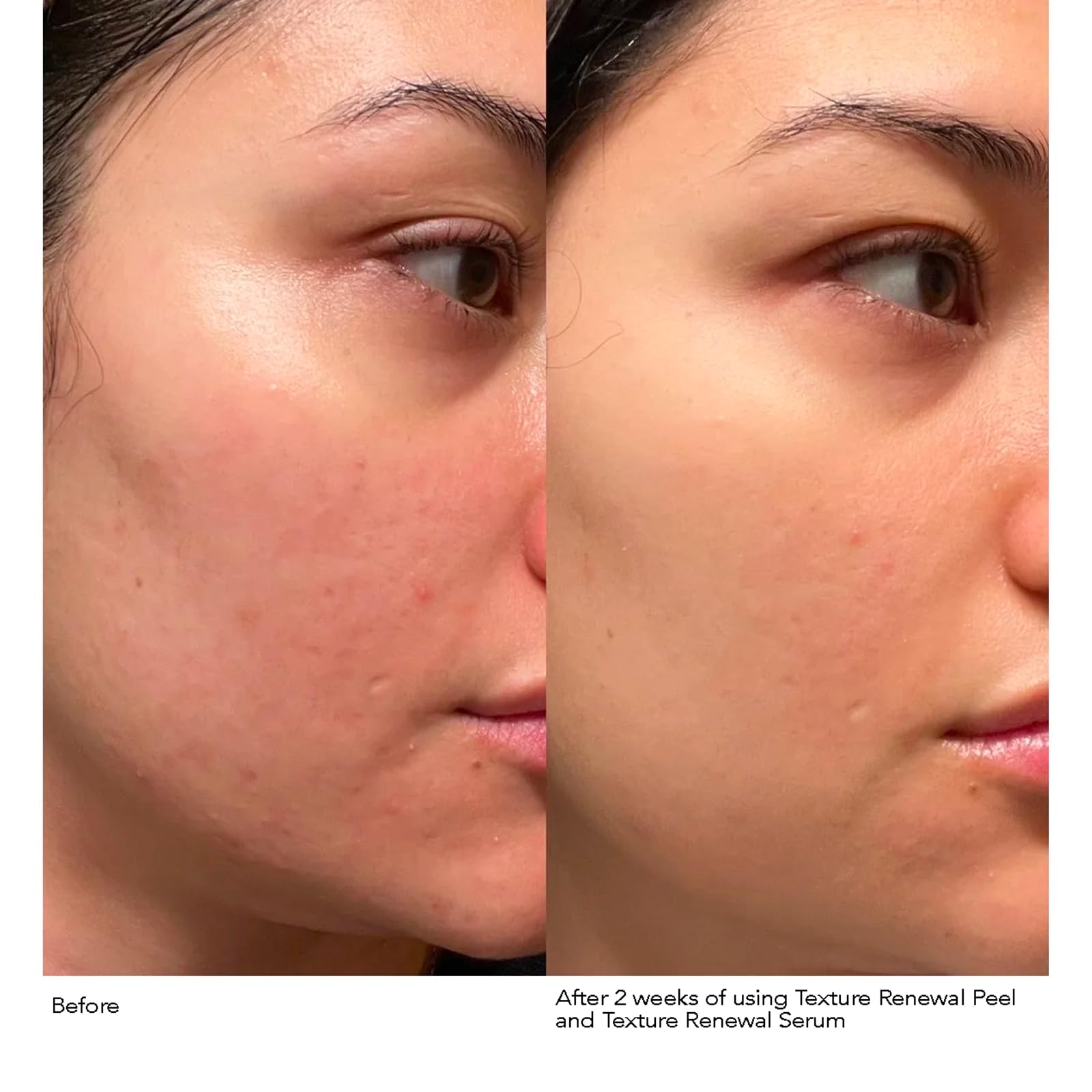 Foto 6 pulgar | Sérum Dr. Dennis Gross Advanced Retinol + Ferúlico 30 Ml - Venta Internacional.