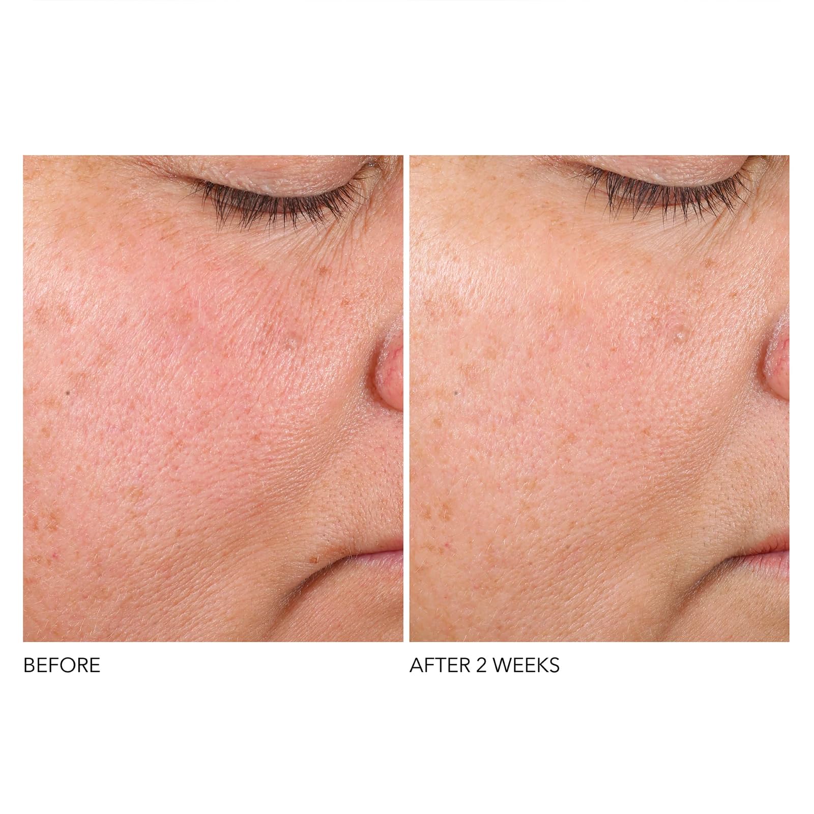 Foto 7 pulgar | Sérum Dr. Dennis Gross Advanced Retinol + Ferúlico 30 Ml - Venta Internacional.
