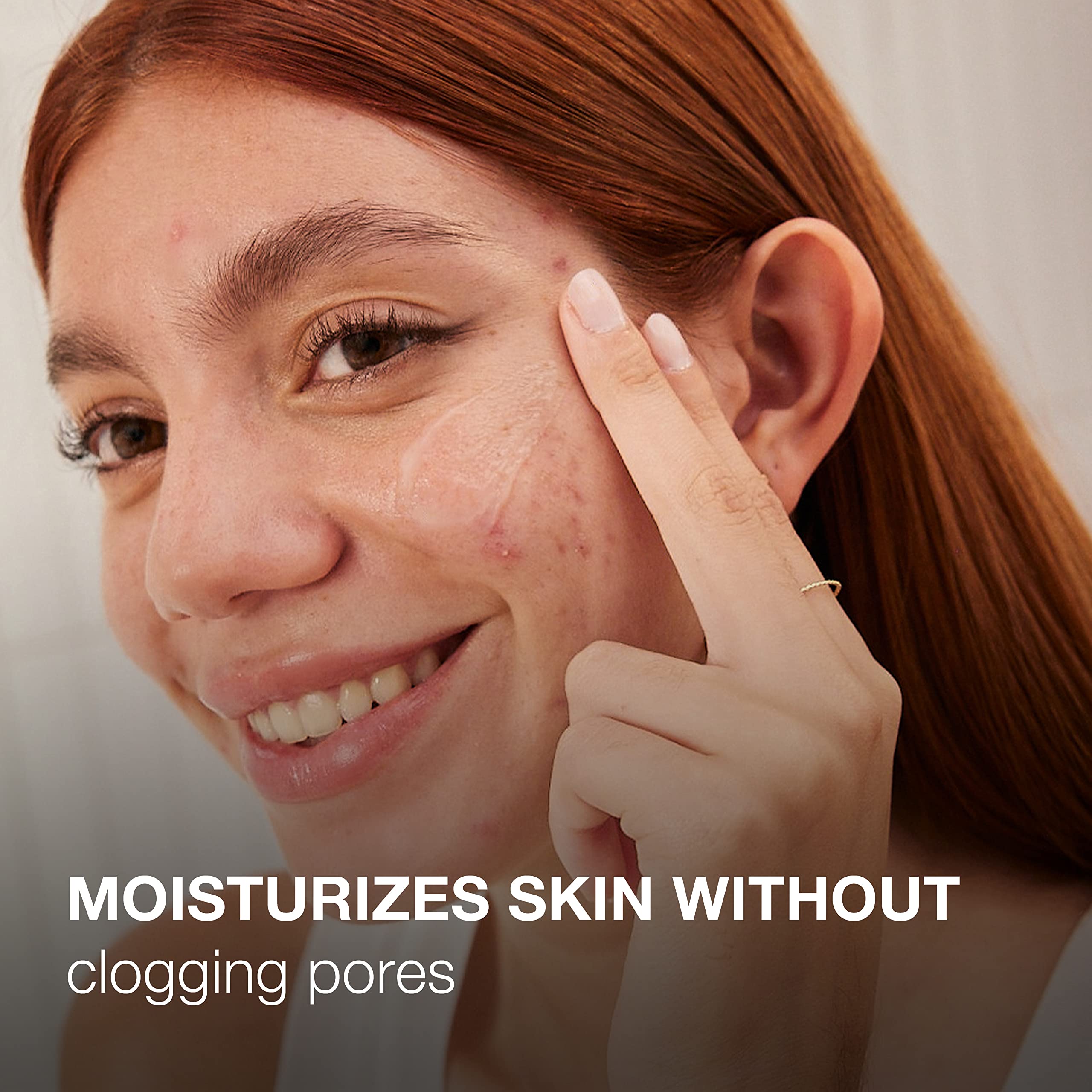 Foto 4 pulgar | Gel Hidratante Facial Neutrogena Ultra Suave, 150 Ml, Propenso Al Acné - Venta Internacional.