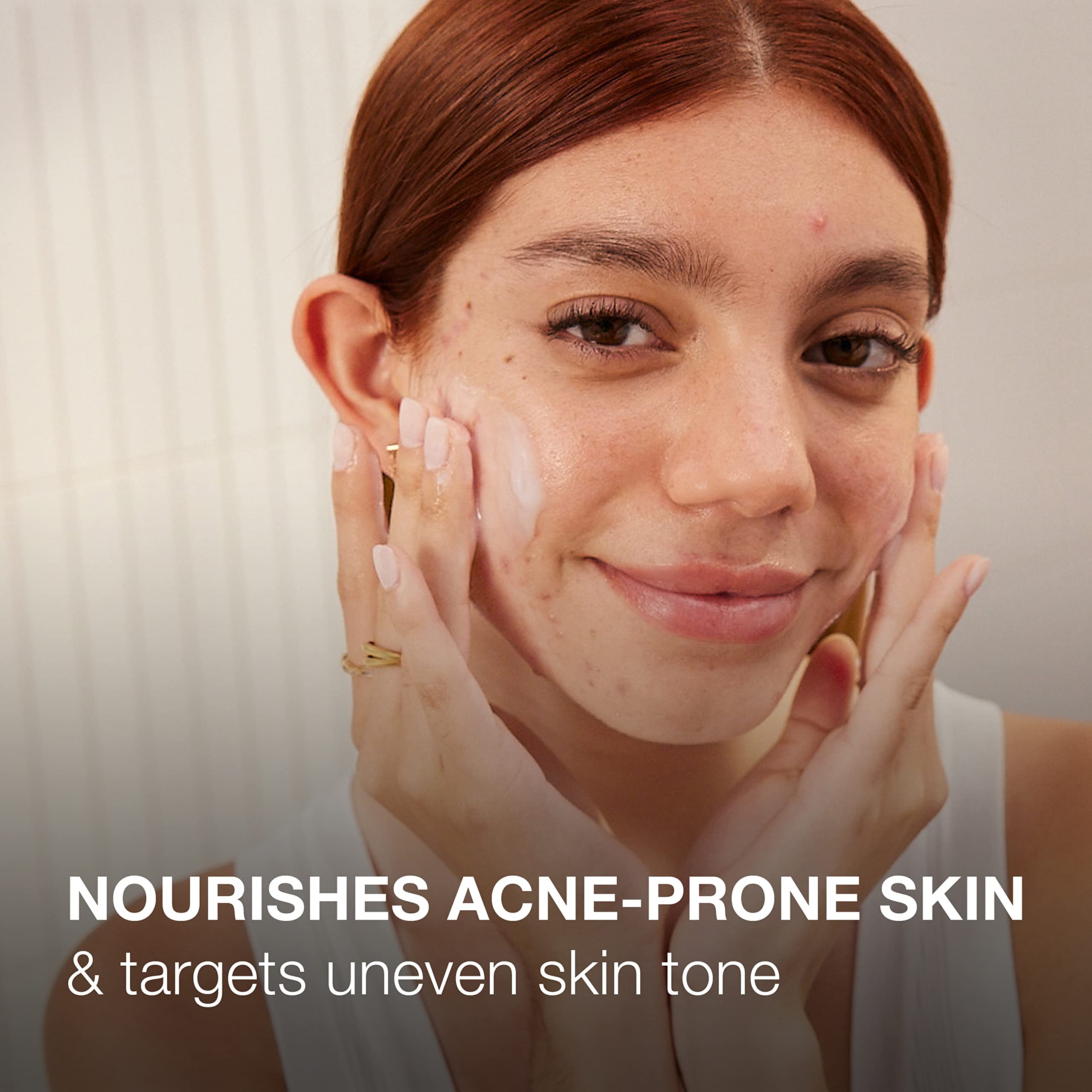 Foto 5 | Gel Hidratante Facial Neutrogena Ultra Suave, 150 Ml, Propenso Al Acné - Venta Internacional.