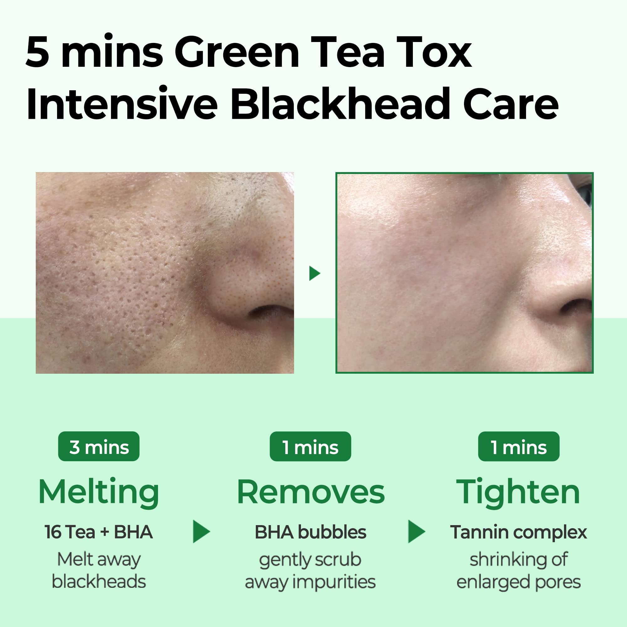 Foto 4 pulgar | Limpiador Some By Mi Bye Blackhead 30 Days Miracle 120 Ml - Venta Internacional.