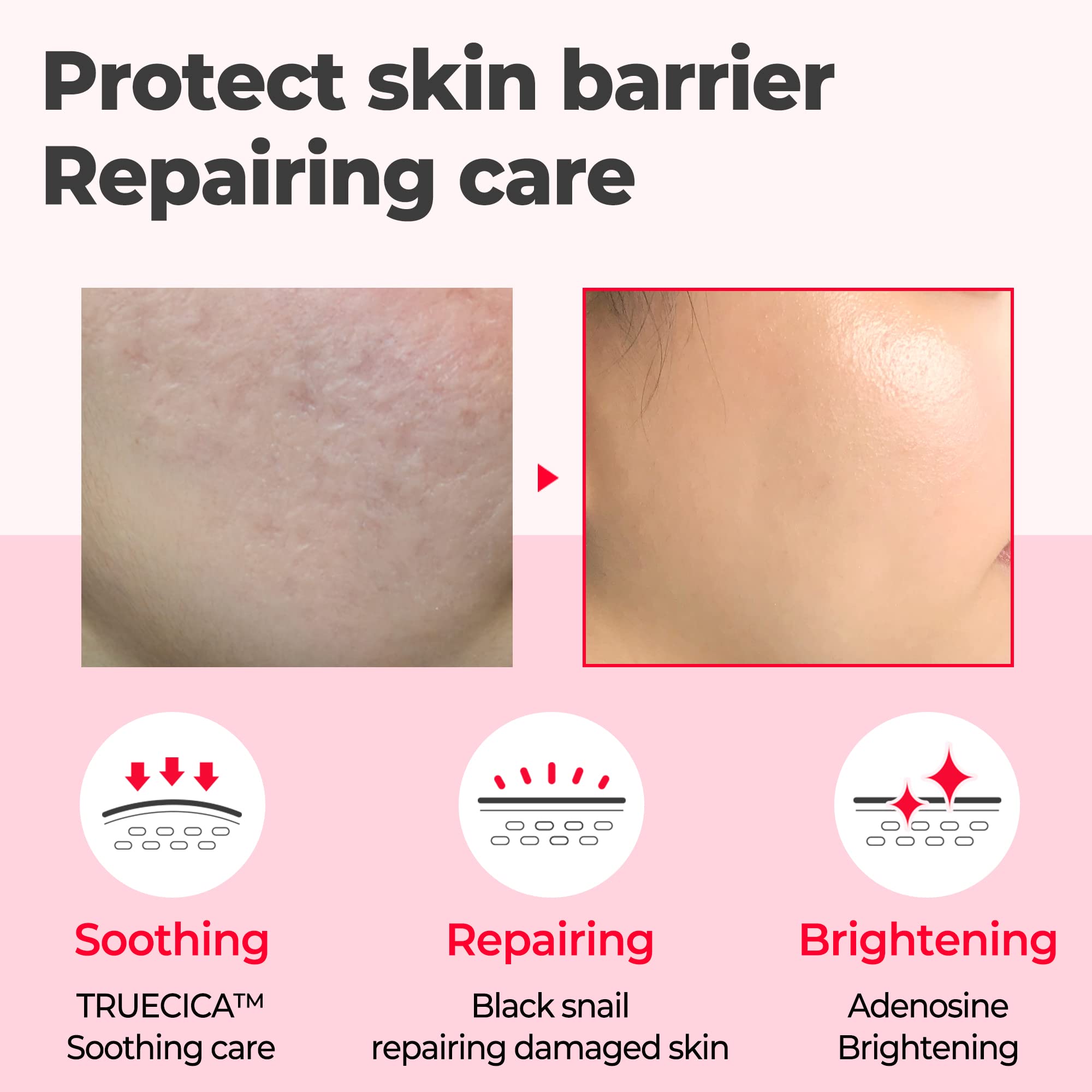 Foto 4 pulgar | Sérum Some By Mi Snail Trucica Miracle Repair De 50 Ml Para Piel - Venta Internacional.
