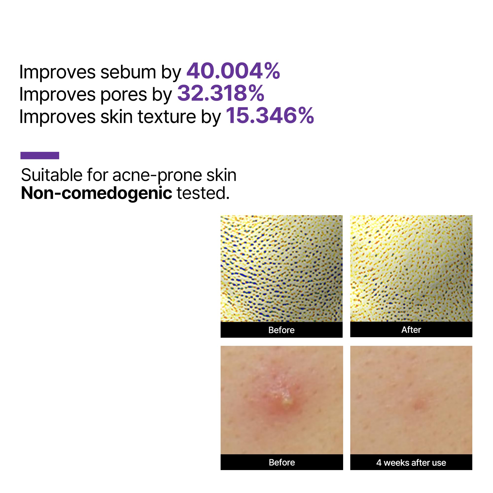 Foto 6 pulgar | Sérum Some By Mi Retinol Reactivante Intenso 30 Ml Con Retinol Al 0,1% - Venta Internacional.