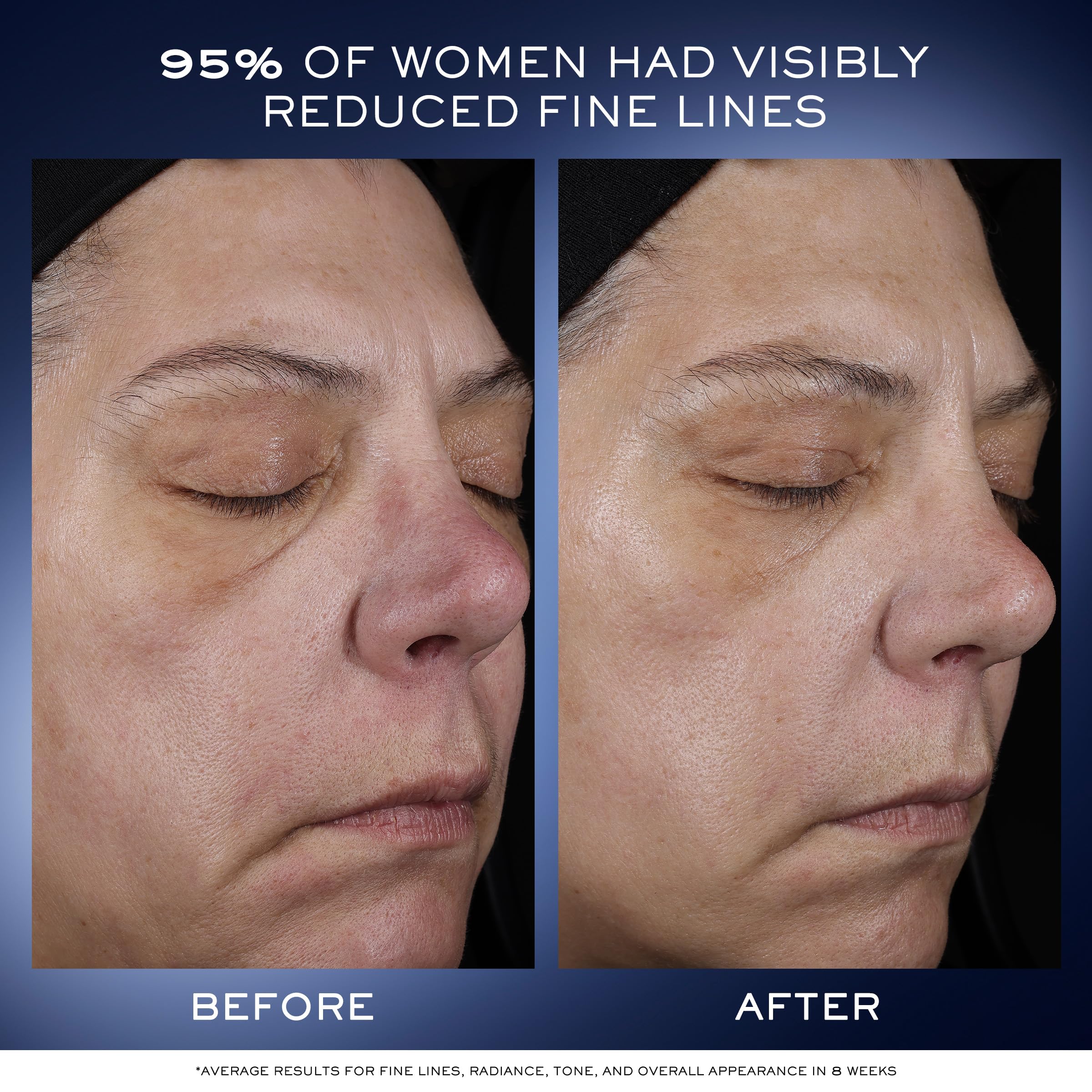 Foto 5 pulgar | Sérum Facial Lancôme Génifique Ultimate Dual Recovery 20 Ml - Venta Internacional.