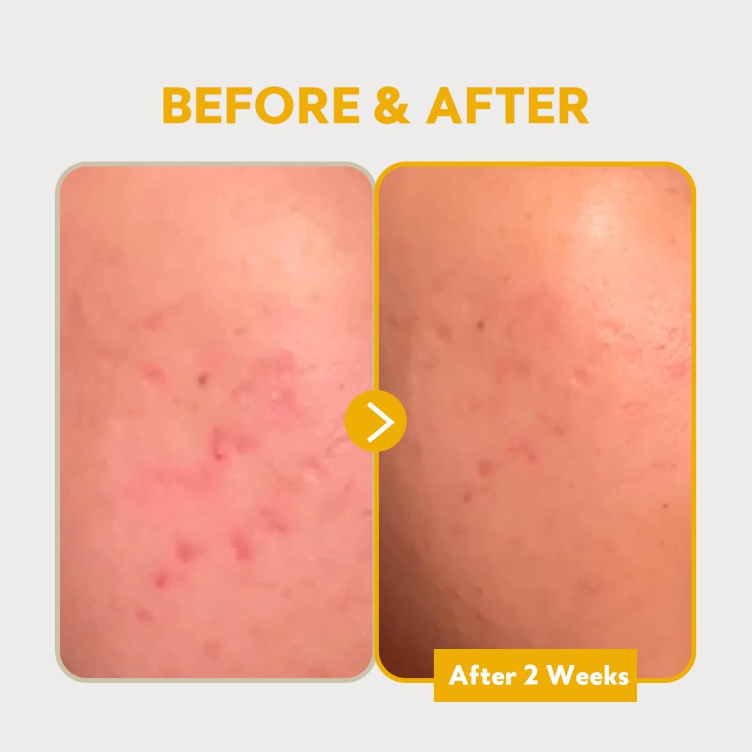 Foto 6 pulgar | Sérum Tirtir Pure Vitamin C 24% 30 Ml Para Iluminar Los Tonos De La Piel - Venta Internacional.