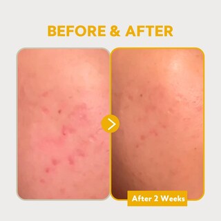 Foto 5 | Sérum Tirtir Pure Vitamin C 24% 30 Ml Para Iluminar Los Tonos De La Piel - Venta Internacional.