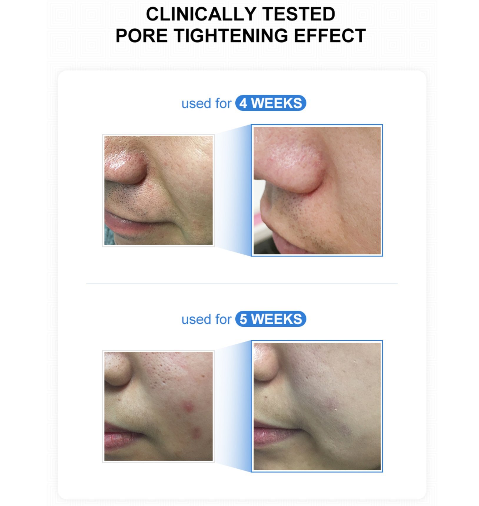 Foto 5 | Sérum Hidratante Medicube Zero Pore De 27 Ml Con Aloe Vera Y Vitamina E - Venta Internacional.