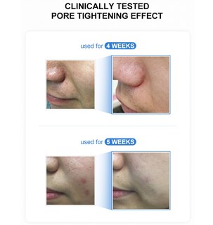 Foto 5 | Sérum Hidratante Medicube Zero Pore De 27 Ml Con Aloe Vera Y Vitamina E - Venta Internacional.