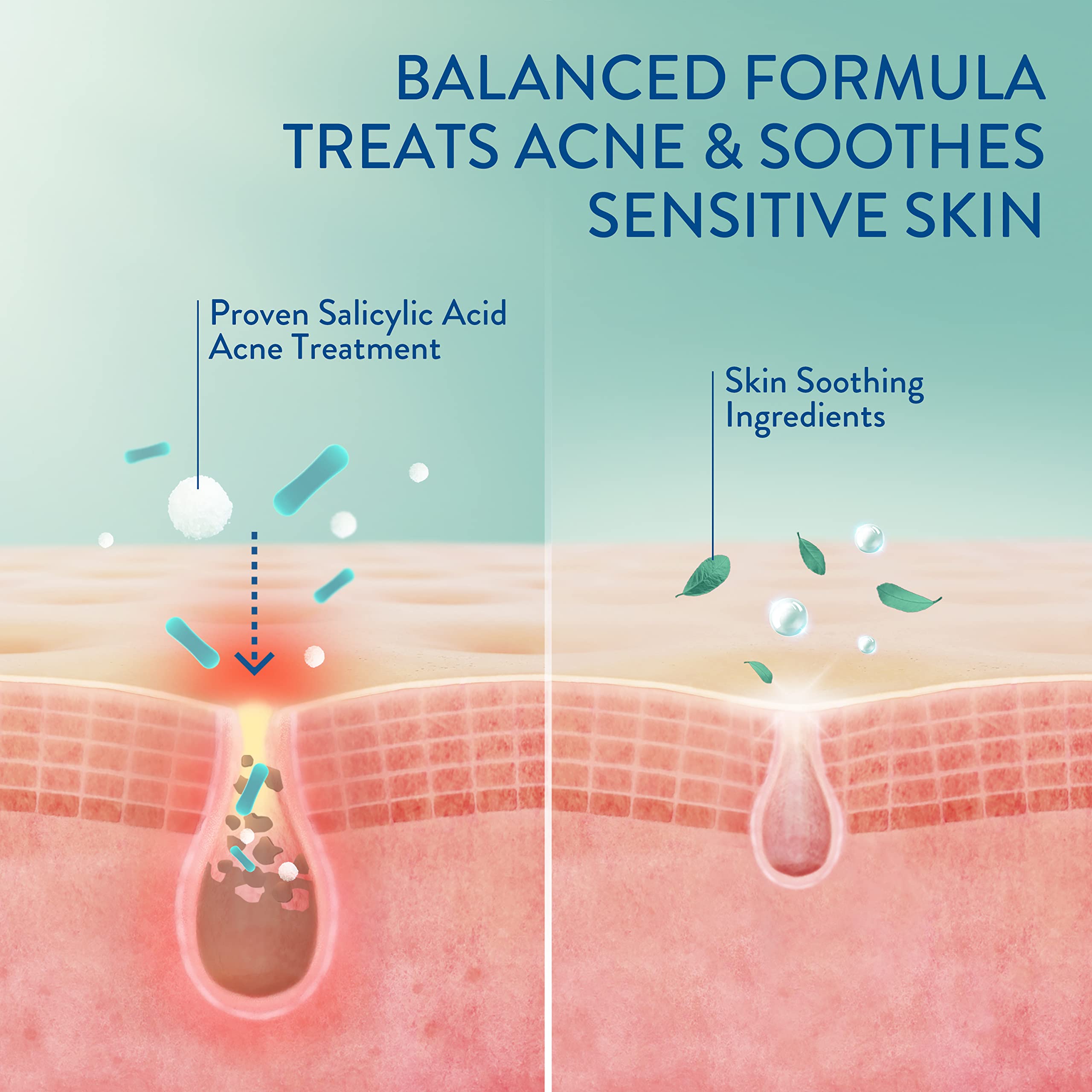 Foto 3 | Sérum Cetaphil Gentle Clear de Triple Acción para el Acné 30 ml con Ácido Salicílico - Venta Internacional