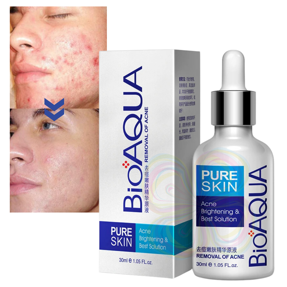 Foto 1 | Serum Pure Skin Retira Acne Y Espinillas Regenera