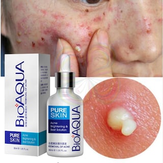 Foto 2 | Serum Pure Skin Retira Acne Y Espinillas Regenera