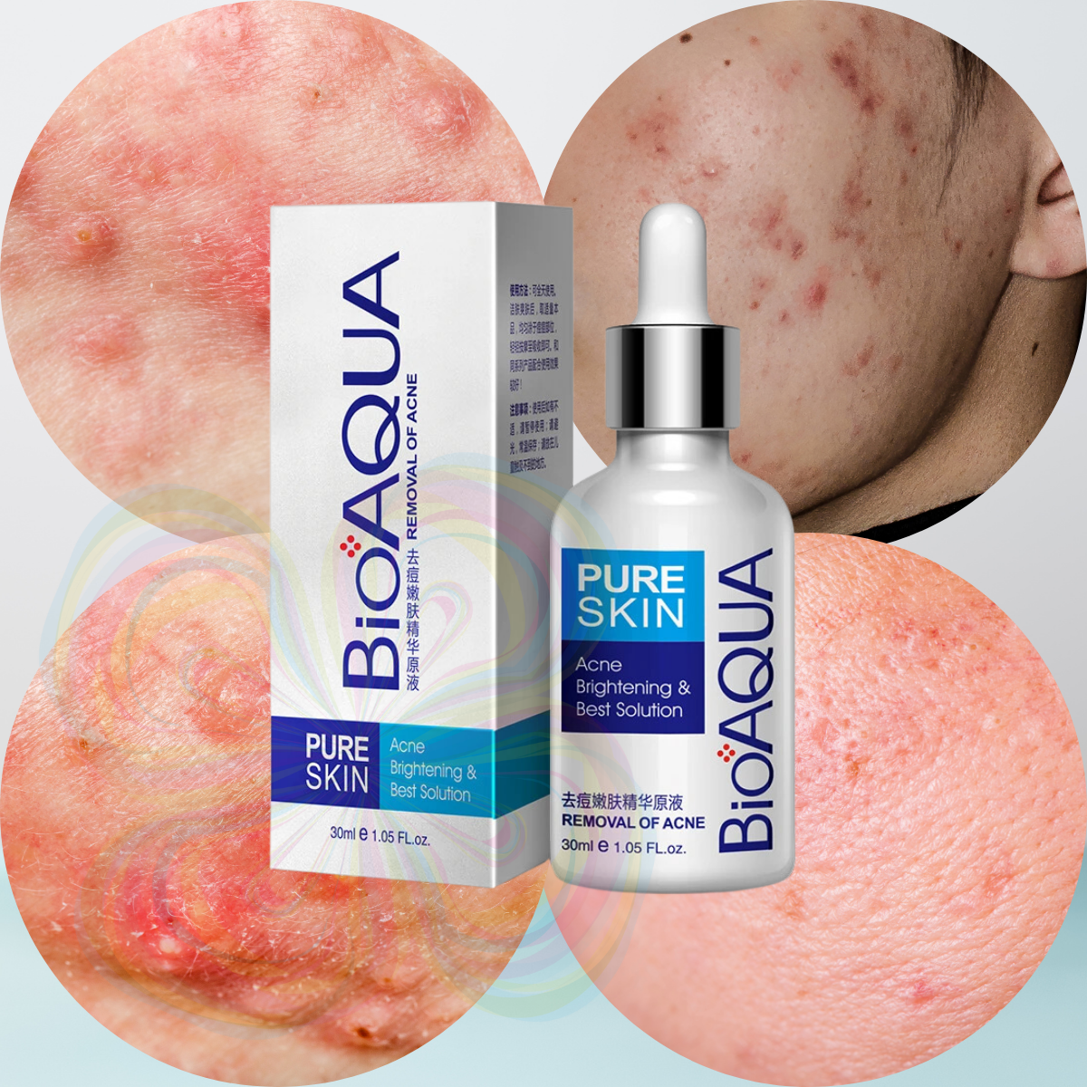 Foto 7 pulgar | Serum Pure Skin Retira Acne Y Espinillas Regenera