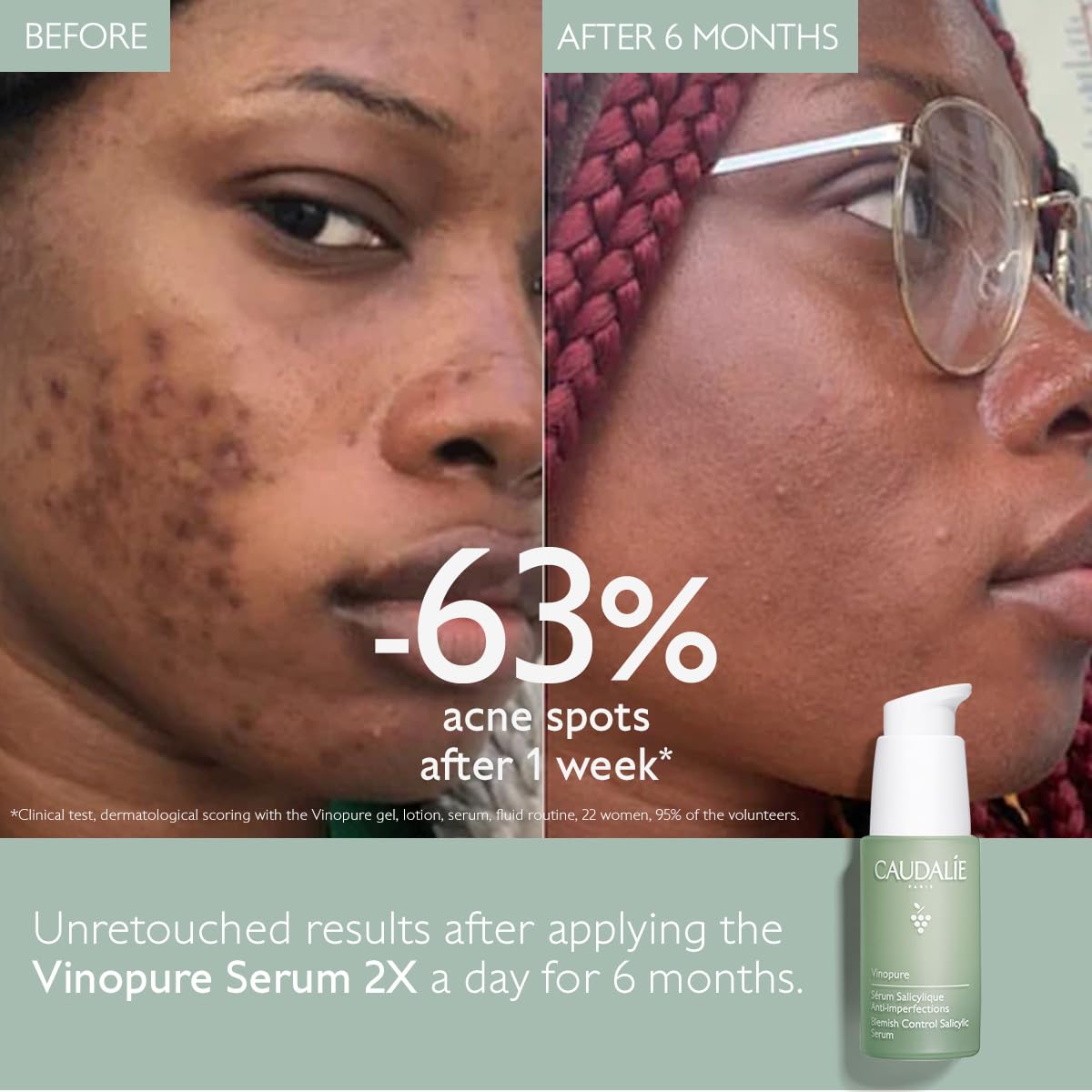 Foto 2 | Sérum Caudalie Vinopure De Ácido Salicílico Natural Para Minimizar Los Poros - Venta Internacional.