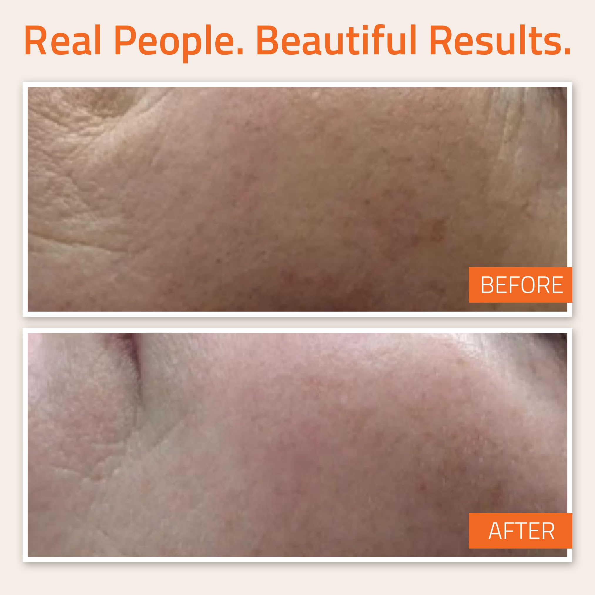 Foto 5 pulgar | Serum Yeouth Sérum Facial Con Vitamina C Y Ácido Hialurónico 60 Ml - Venta Internacional.